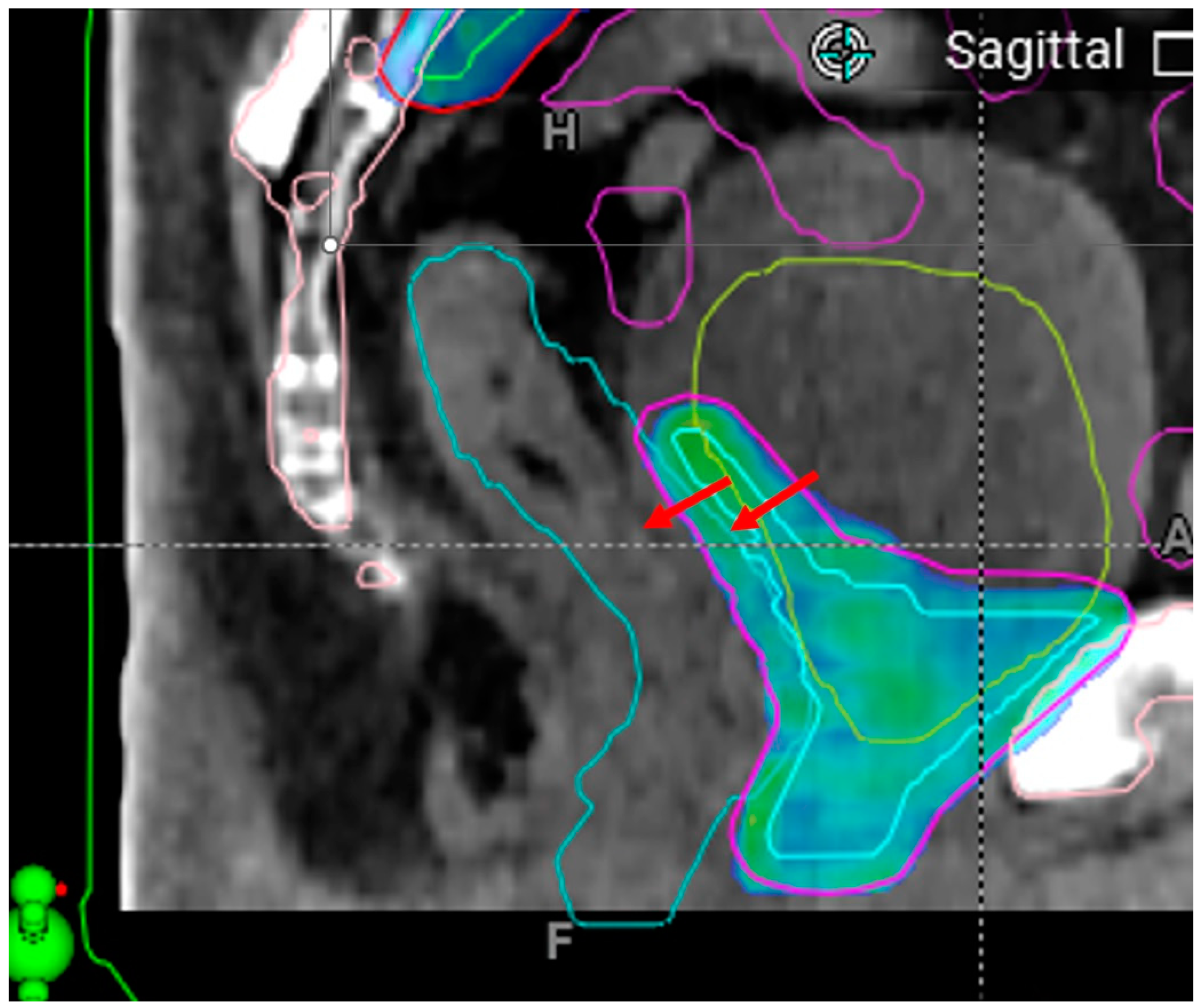 Cancers 17 01462 g008