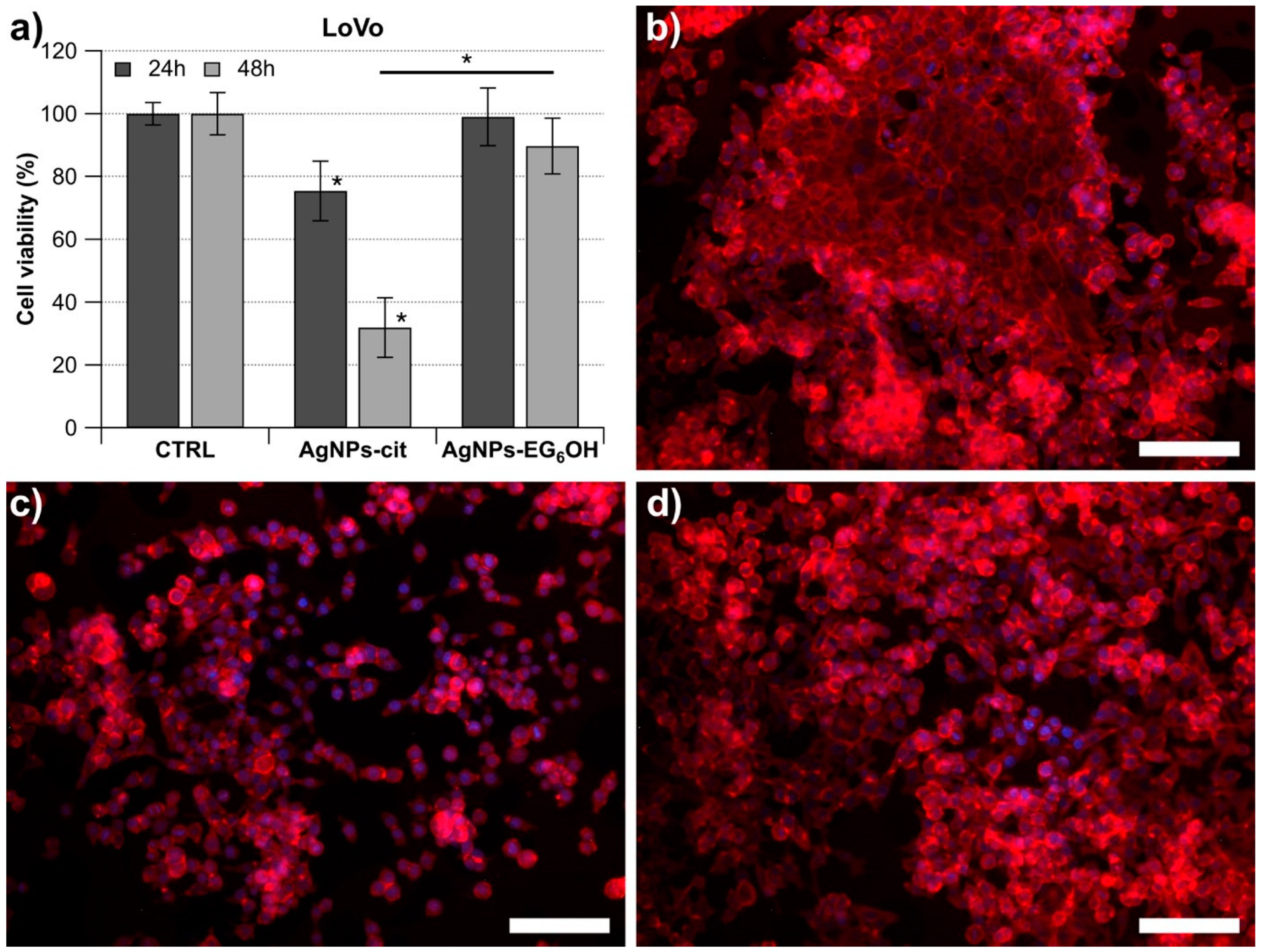 Cancers 17 01475 g002