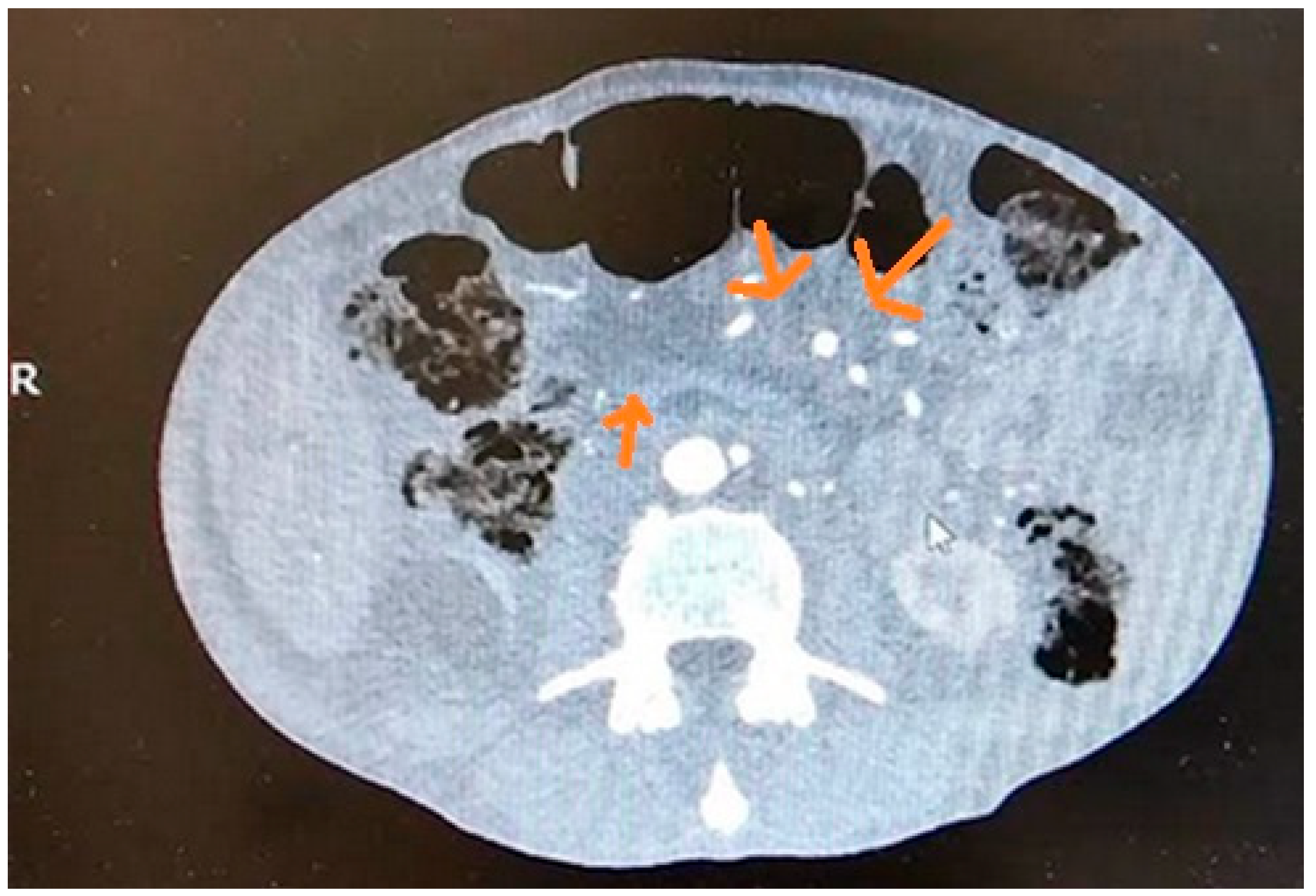 Cancers 17 01891 g001