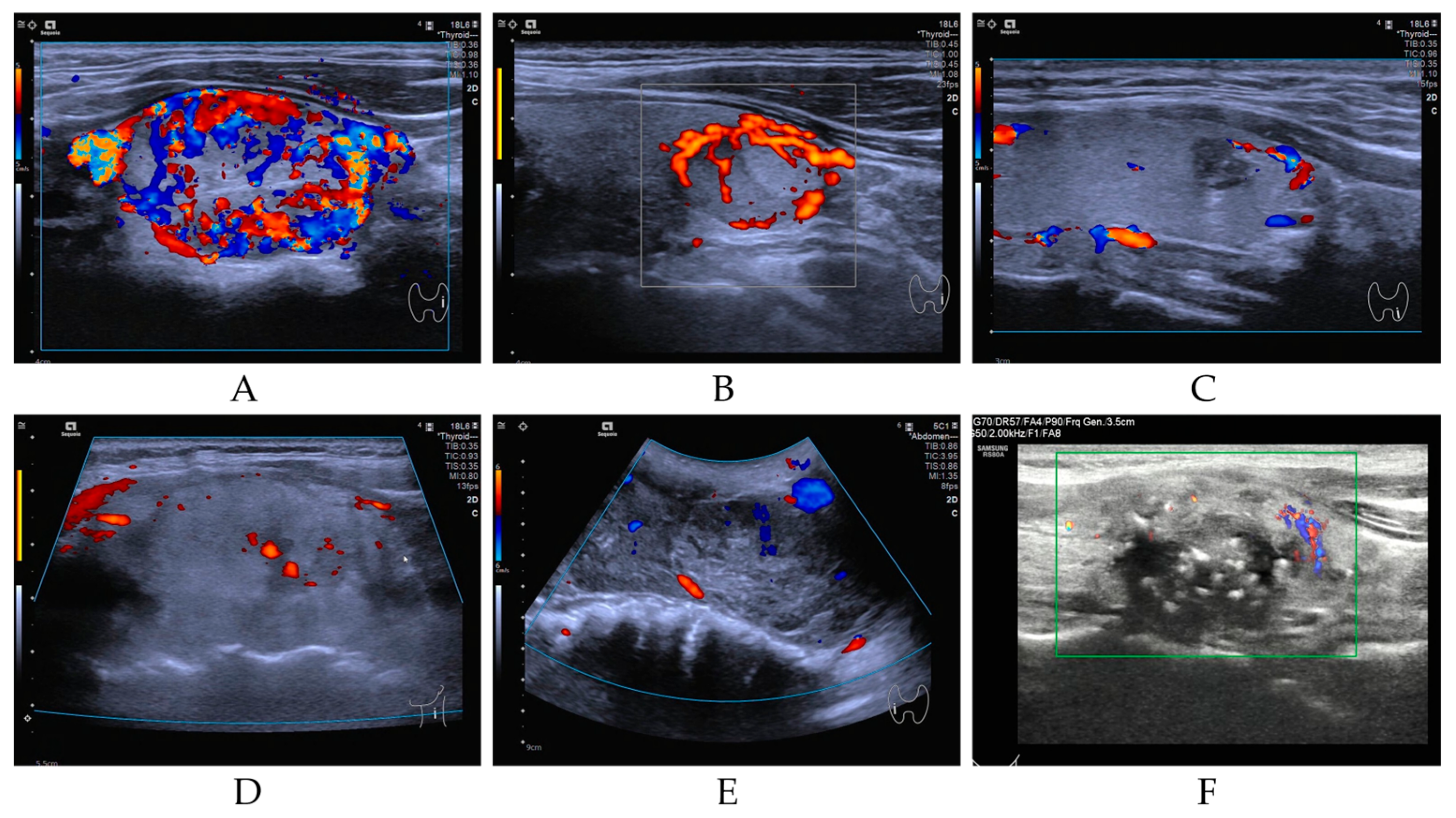 Cancers 17 02429 g002