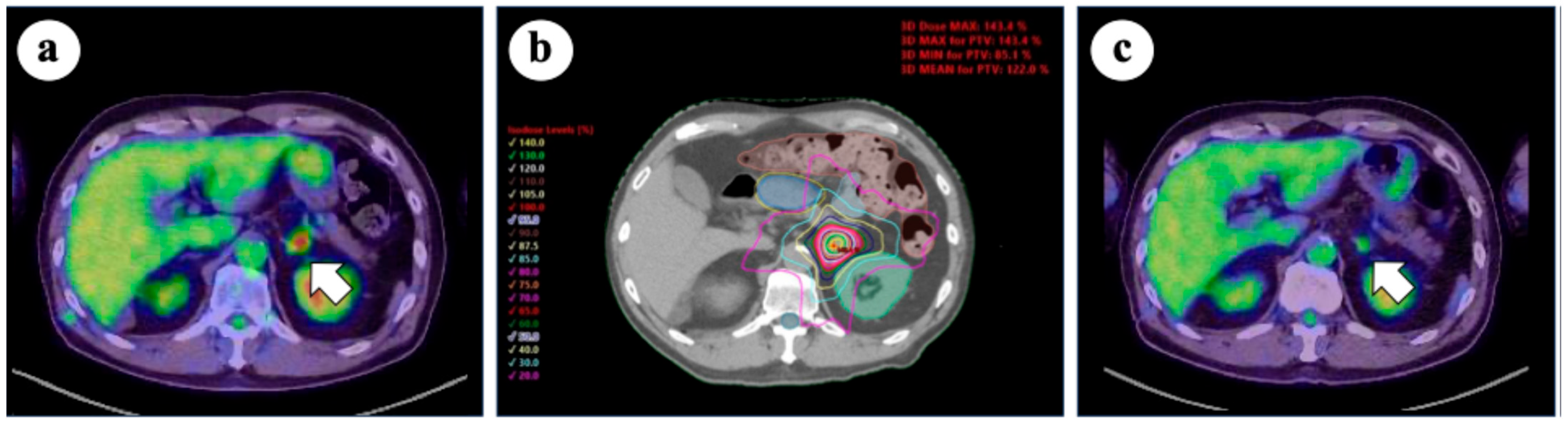 Cancers 17 02569 g002