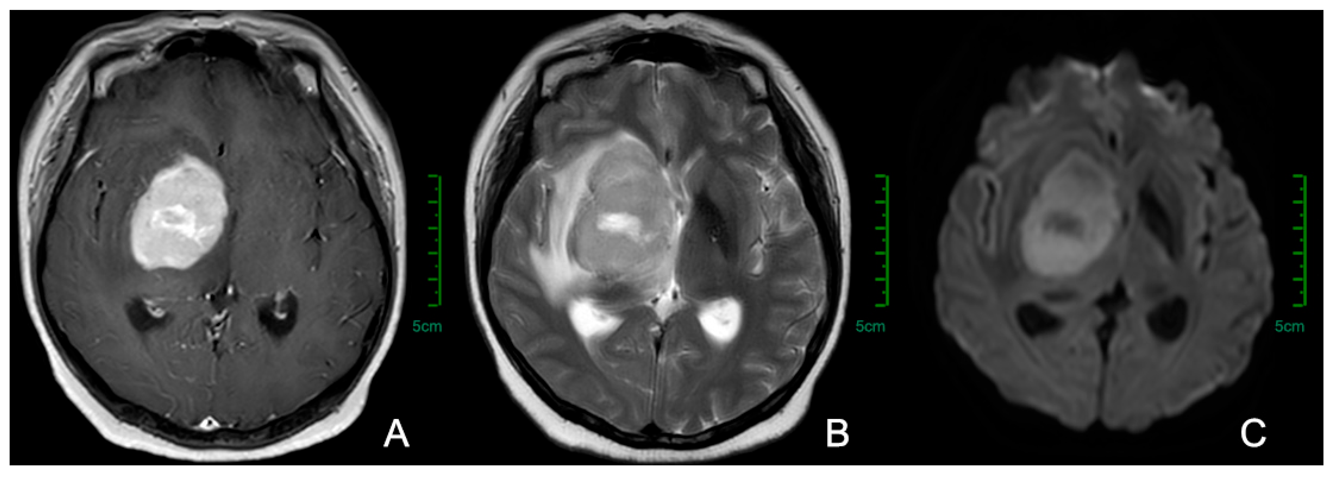 Cancers 17 02909 g001 Cancers 17 02909 g001