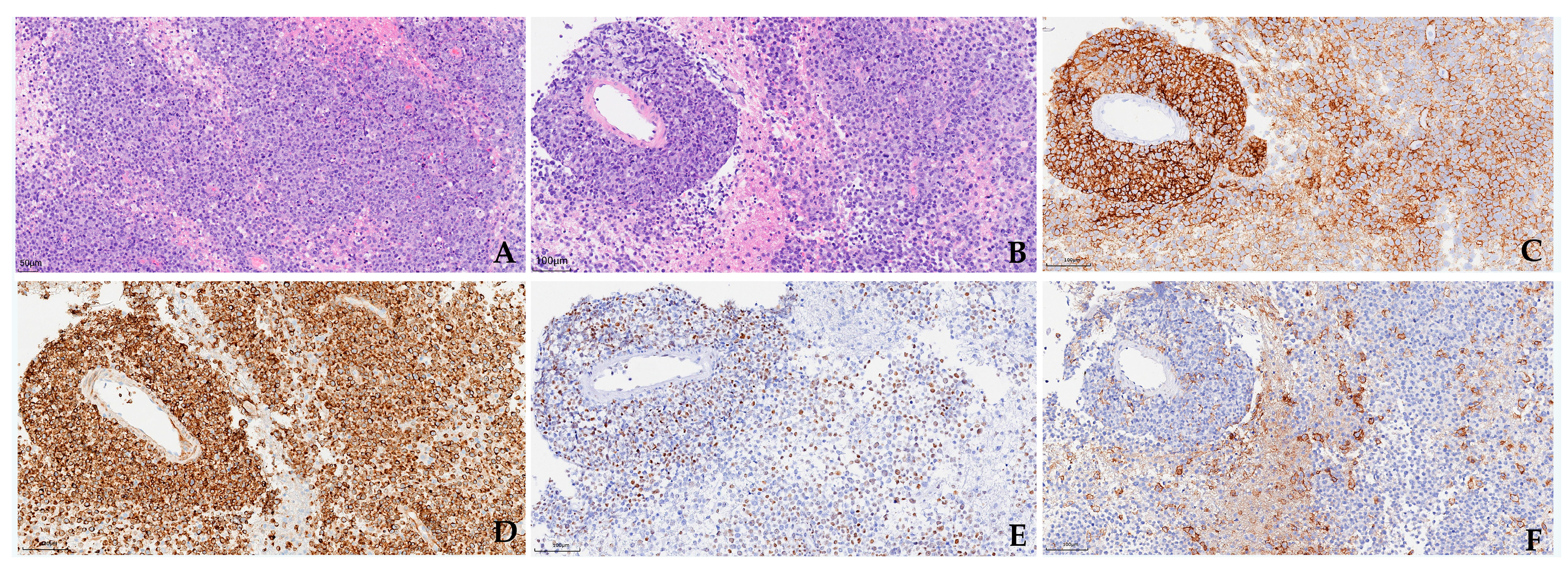 Cancers 17 02909 g002 Cancers 17 02909 g002