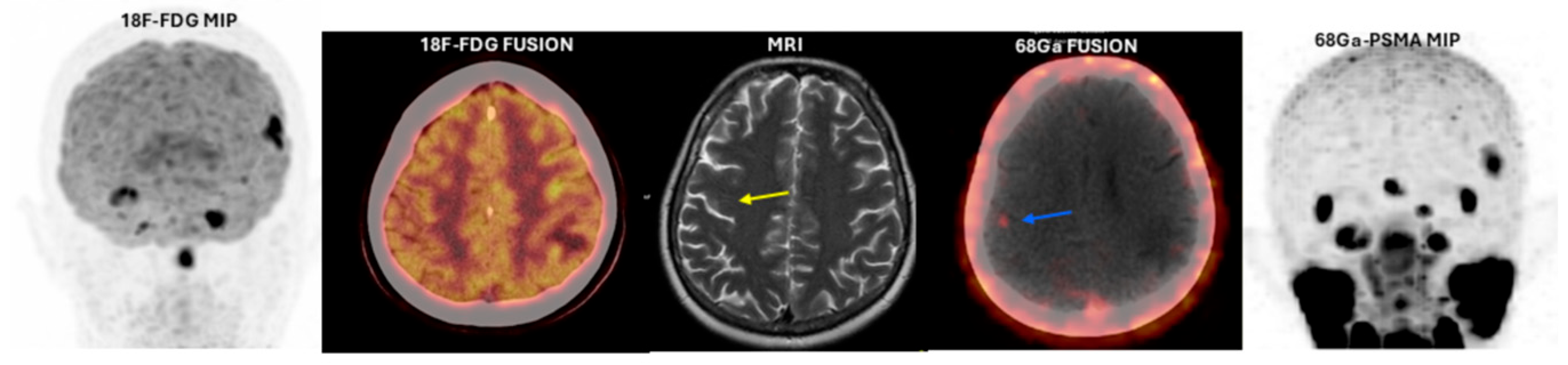 Cancers 17 03088 g001 Cancers 17 03088 g001