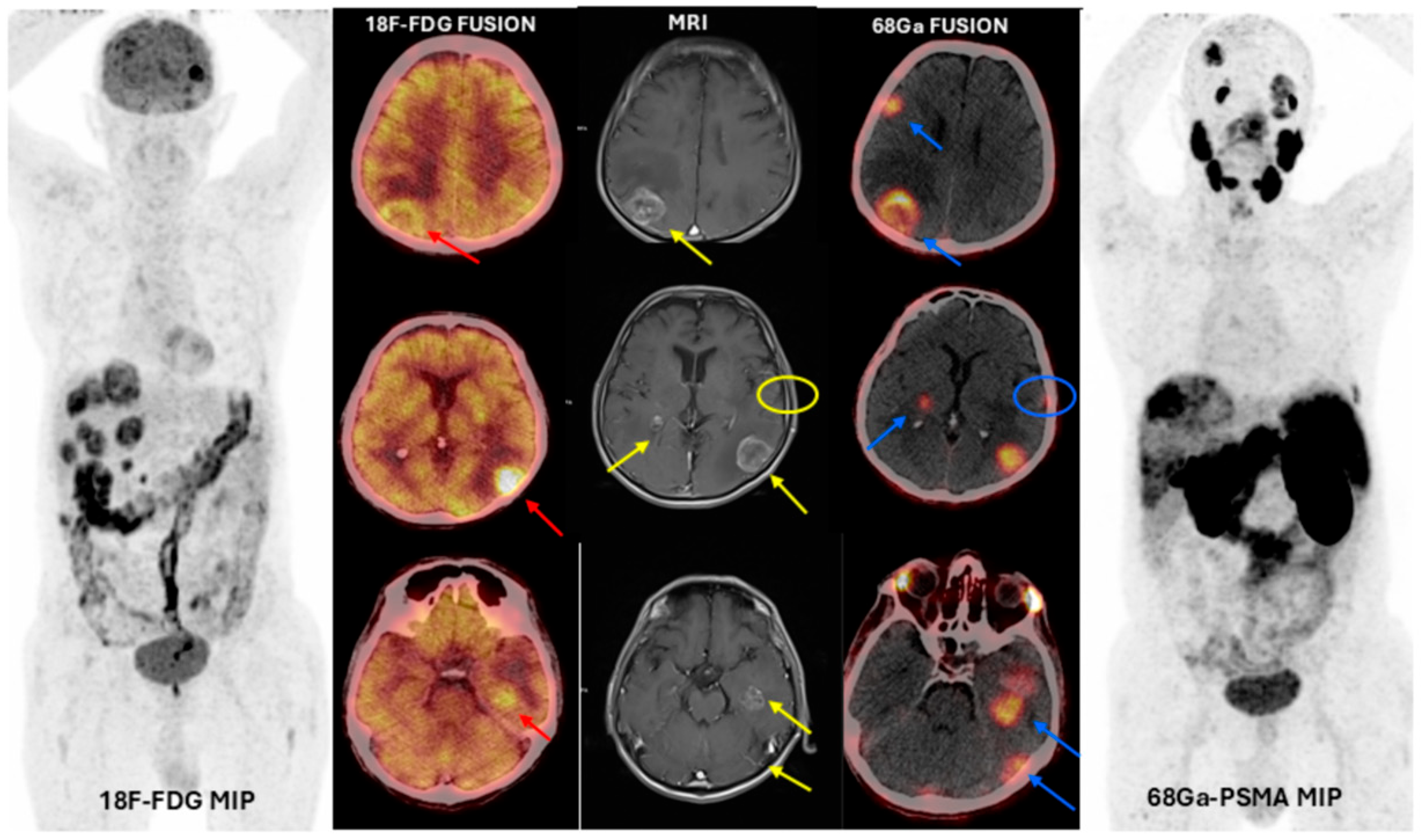 Cancers 17 03088 g002 Cancers 17 03088 g002