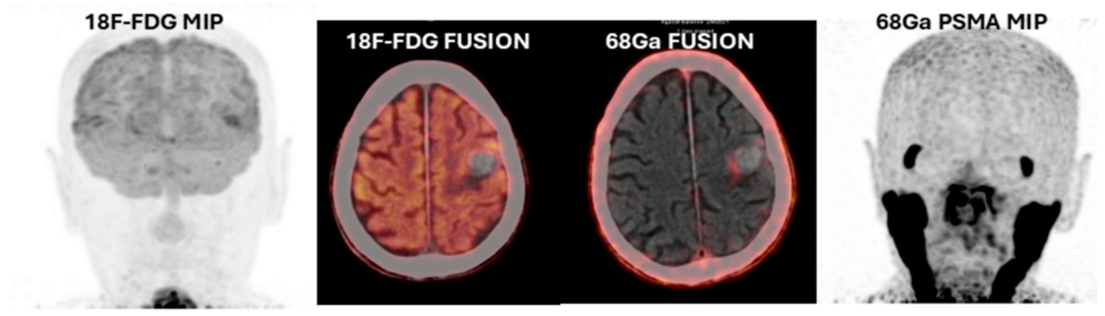 Cancers 17 03088 g003 Cancers 17 03088 g003