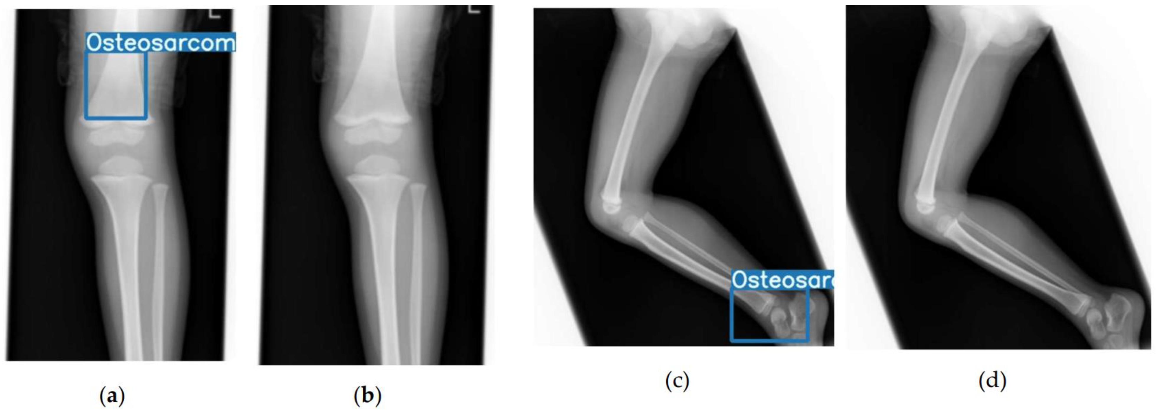 Cancers 17 03144 g004 Cancers 17 03144 g004