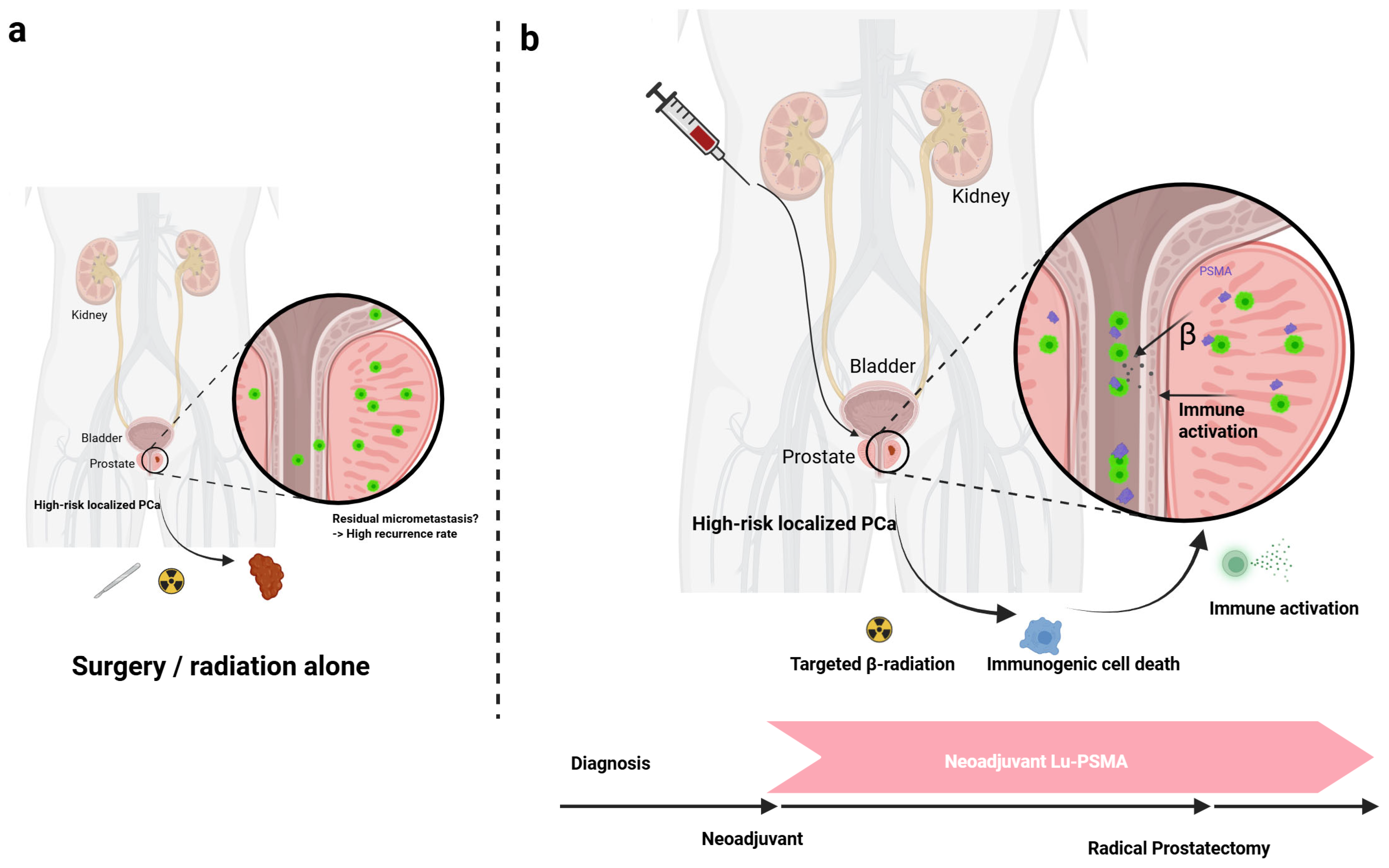 Cancers 17 03330 g001 Cancers 17 03330 g001