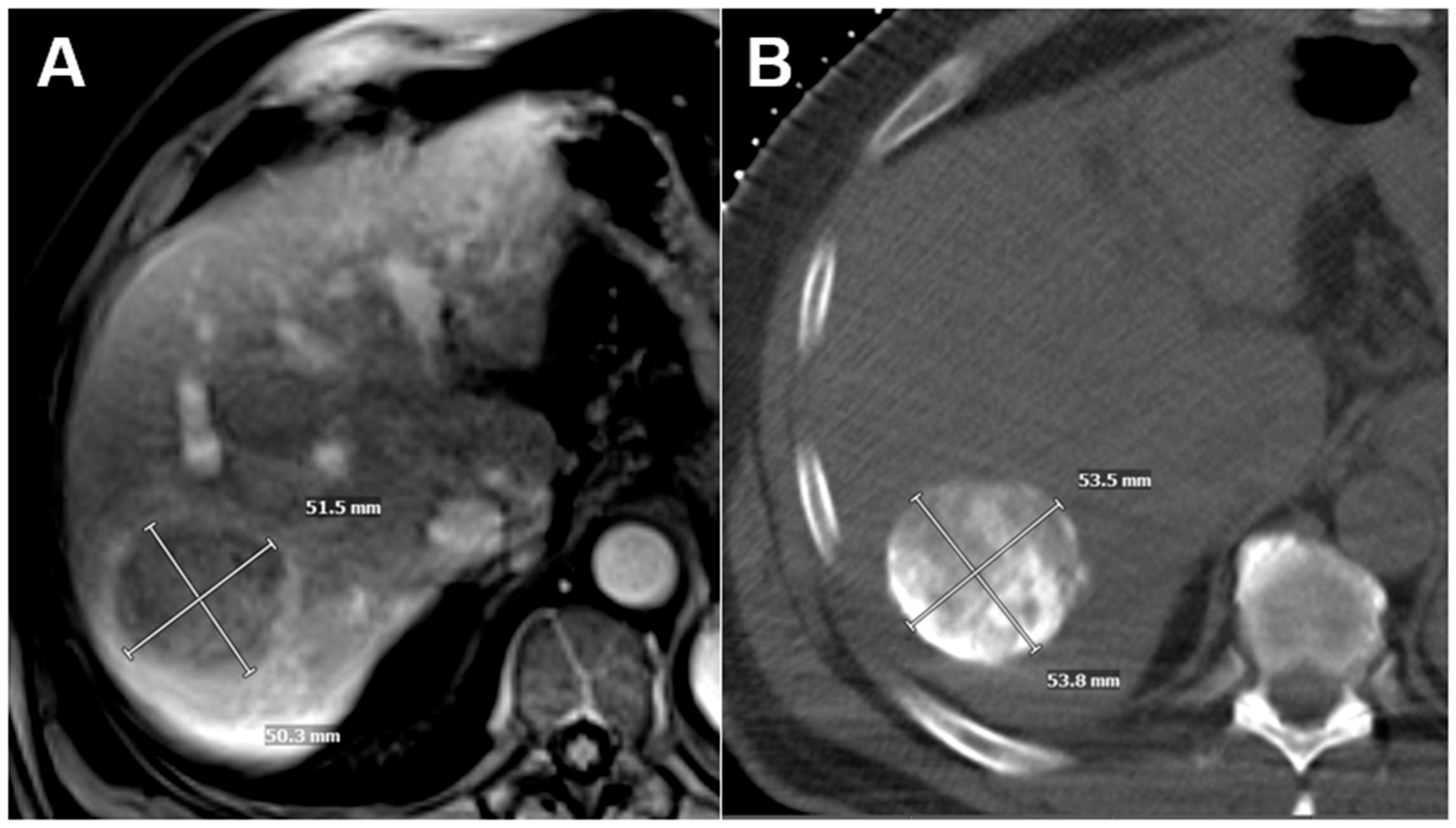Cancers 17 03346 g001 Cancers 17 03346 g001