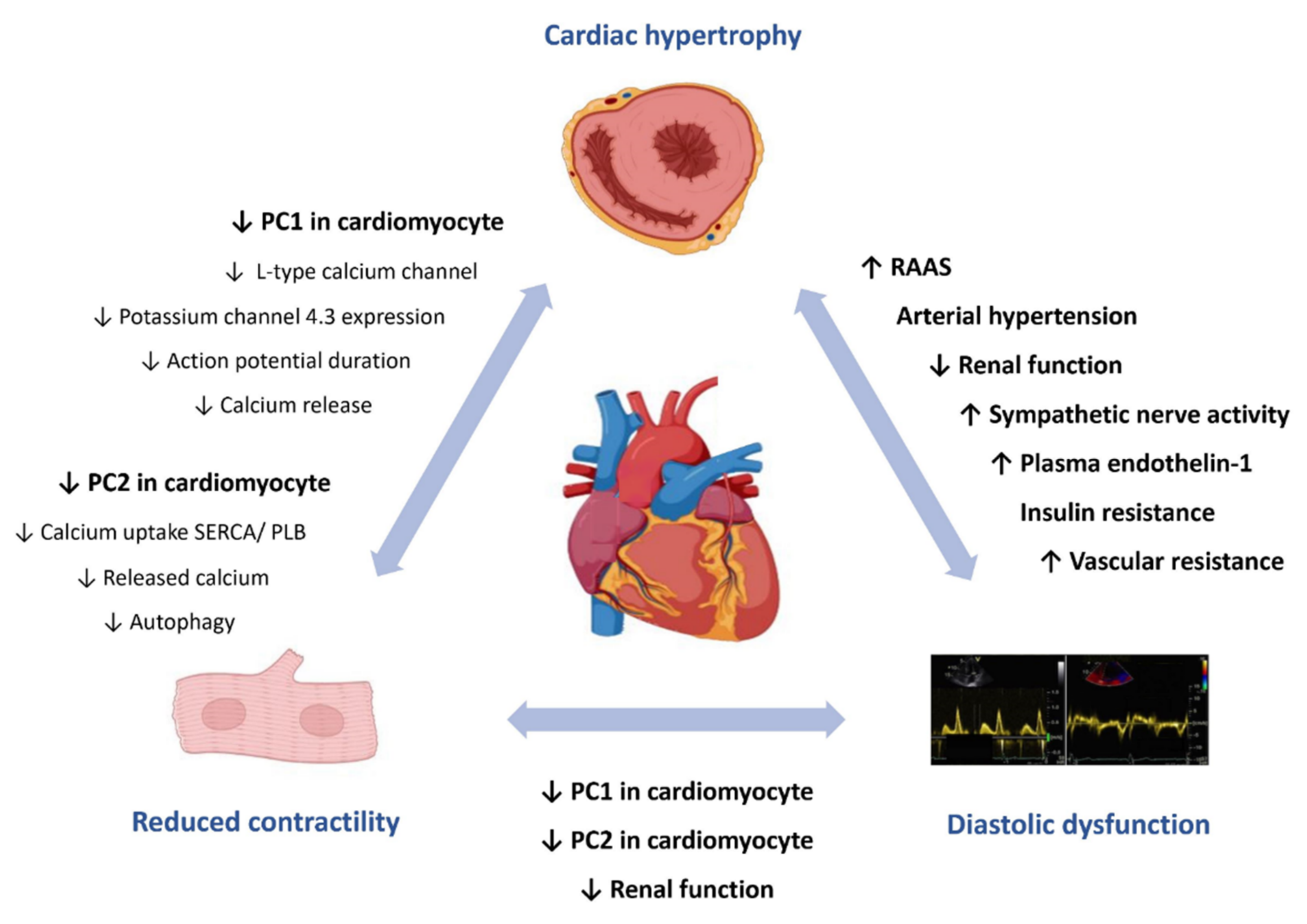Cardiogenetics | Free Full-Text | Cardiac Involvement in Autosomal Dominant  Polycystic Kidney Disease