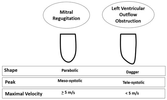 Measuring Left Ventricular Outflow Tract Signal Gradient in