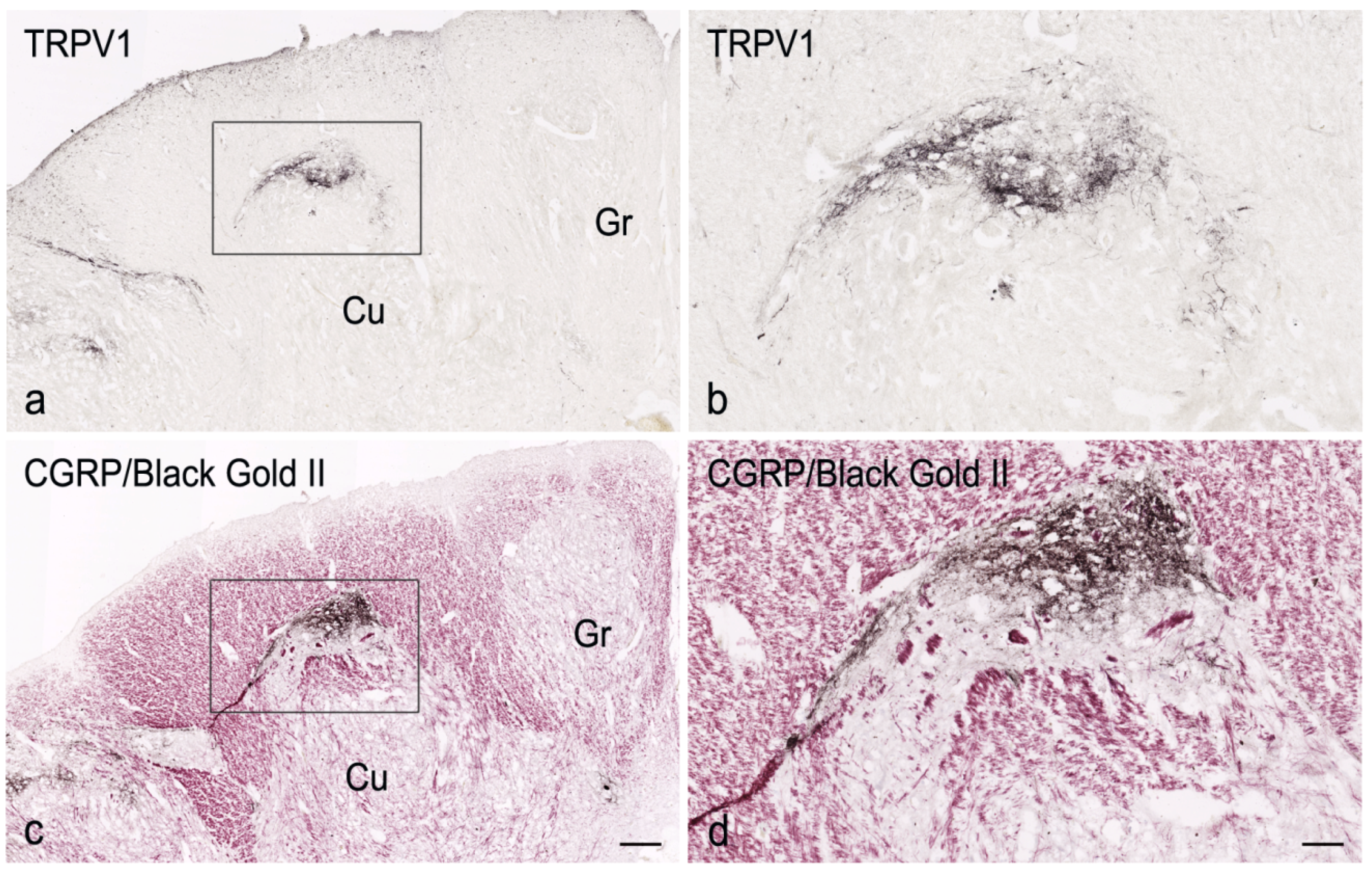 Cells | Free Full-Text | TRPV1-Like Immunoreactivity in the Human