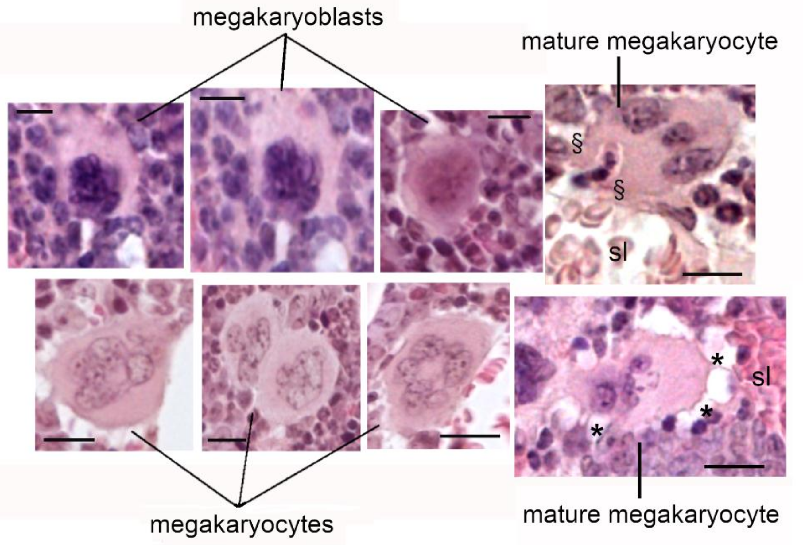 megakaryocyte histology