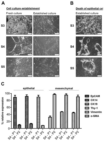 Cells | Free Full-Text | An Effective Primary Head and Neck Squamous Cell  Carcinoma In Vitro Model