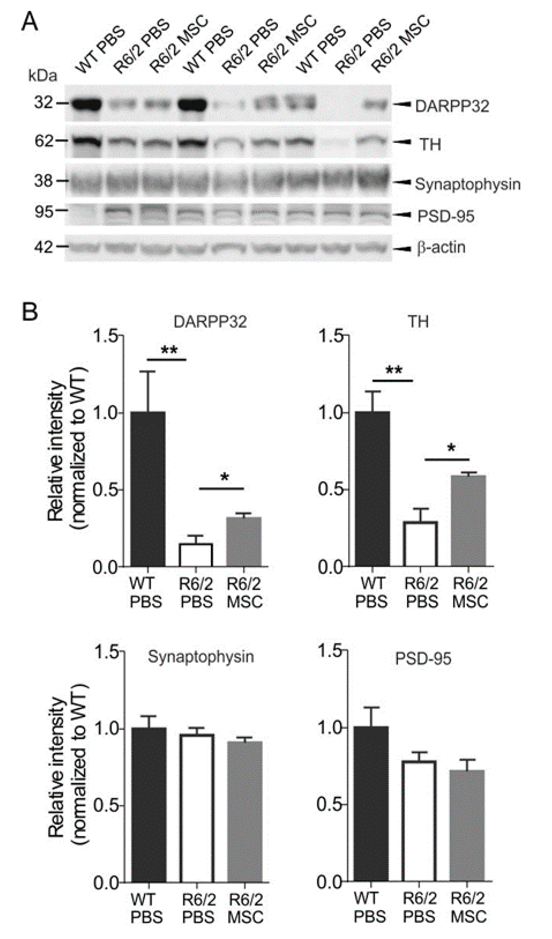 Cells 08 00595 g006 Cells 08 00595 g006