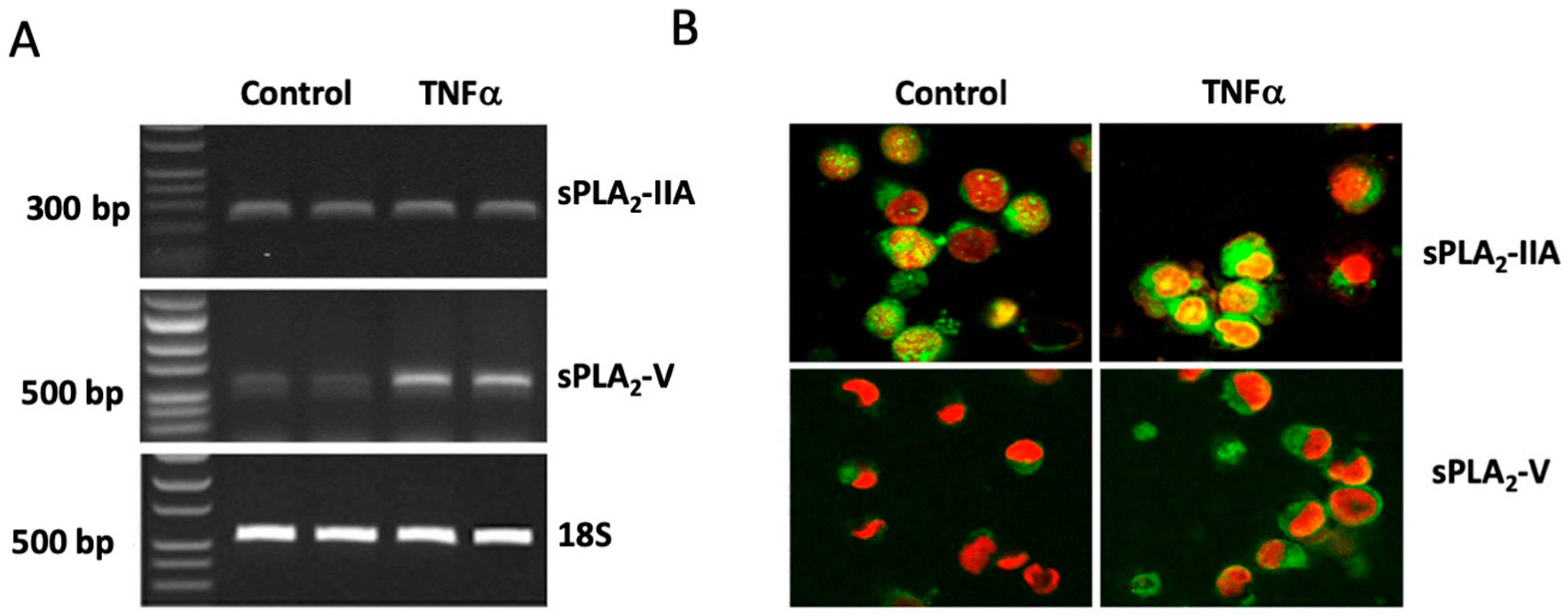 Cells Free Full Text Possible Involvement Of Intracellular Calcium Independent Phospholipase In The Release Of Secretory Phospholipases From Mast Cells Increased Expression In Ileal Mast Cells Of Crohn S Disease Html