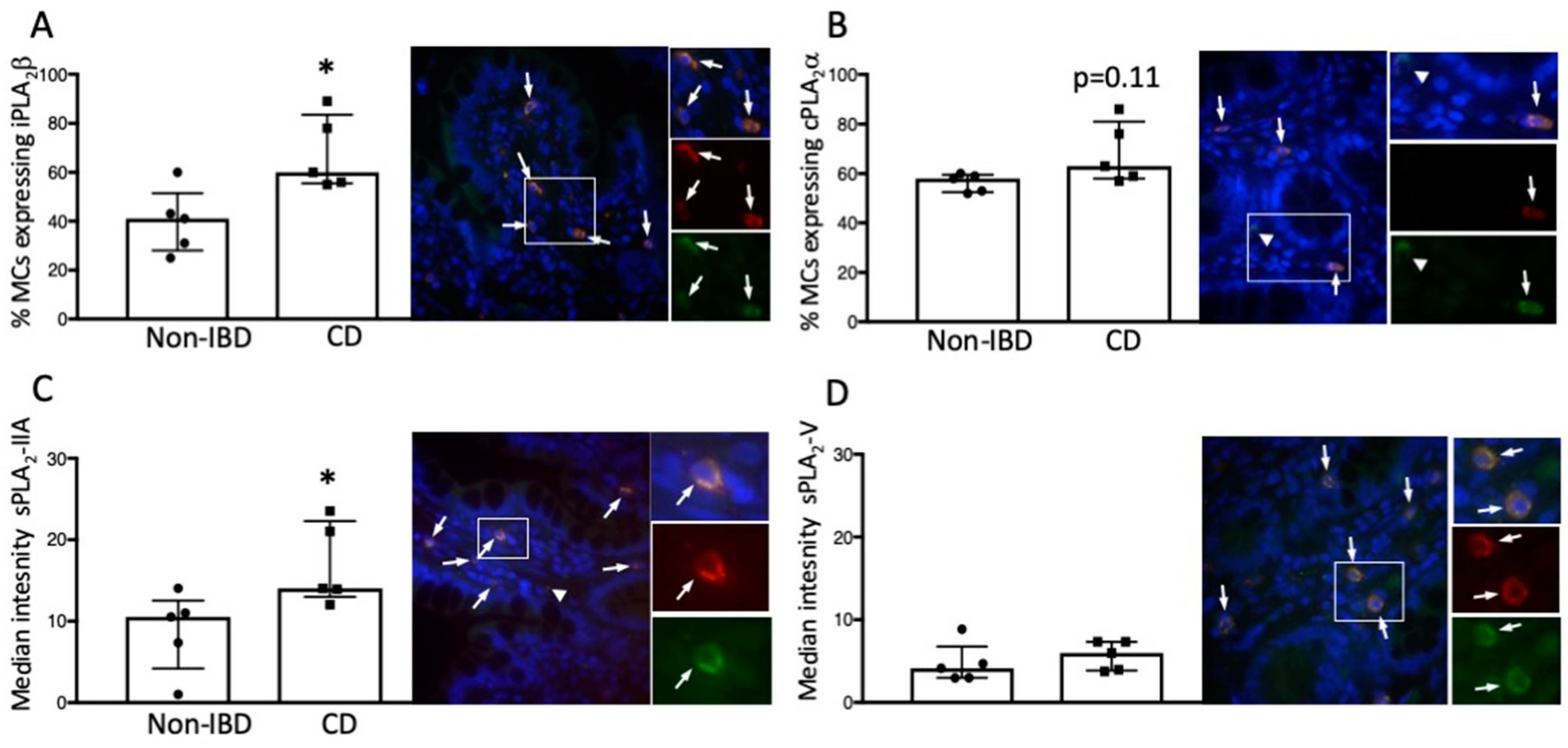 Cells Free Full Text Possible Involvement Of Intracellular Calcium Independent Phospholipase A2 In The Release Of Secretory Phospholipases From Mast Cells Increased Expression In Ileal Mast Cells Of Crohn S Disease Html