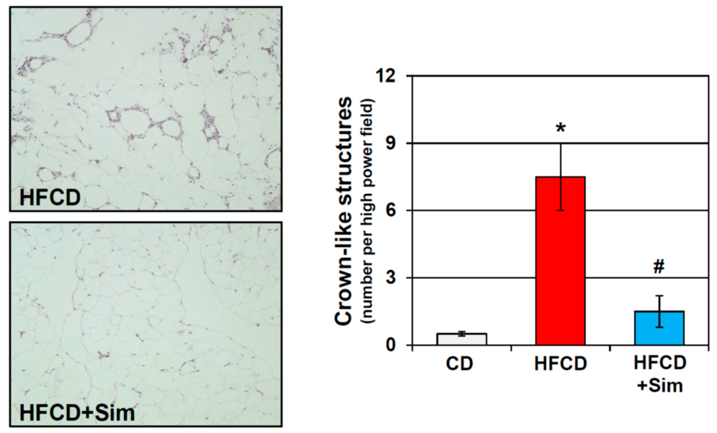 Cells | Free Full-Text | Obesity-Induced Adipose Tissue Inflammation as a  Strong Promotional Factor for Pancreatic Ductal Adenocarcinoma