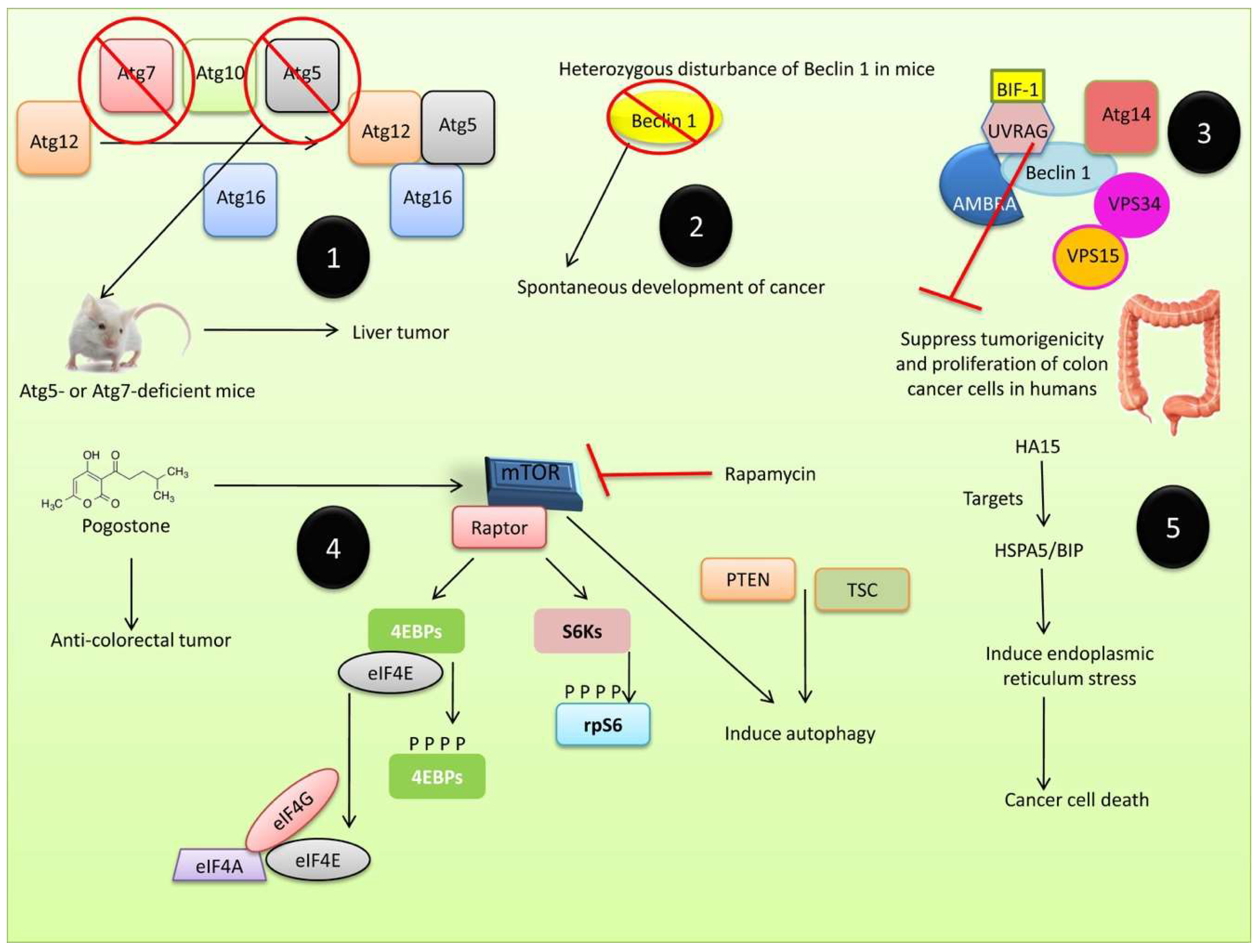 Cells | Free Full-Text | A Comprehensive Review of Autophagy and Its  Various Roles in Infectious, Non-Infectious, and Lifestyle Diseases:  Current Knowledge and Prospects for Disease Prevention, Novel Drug Design,  and Therapy