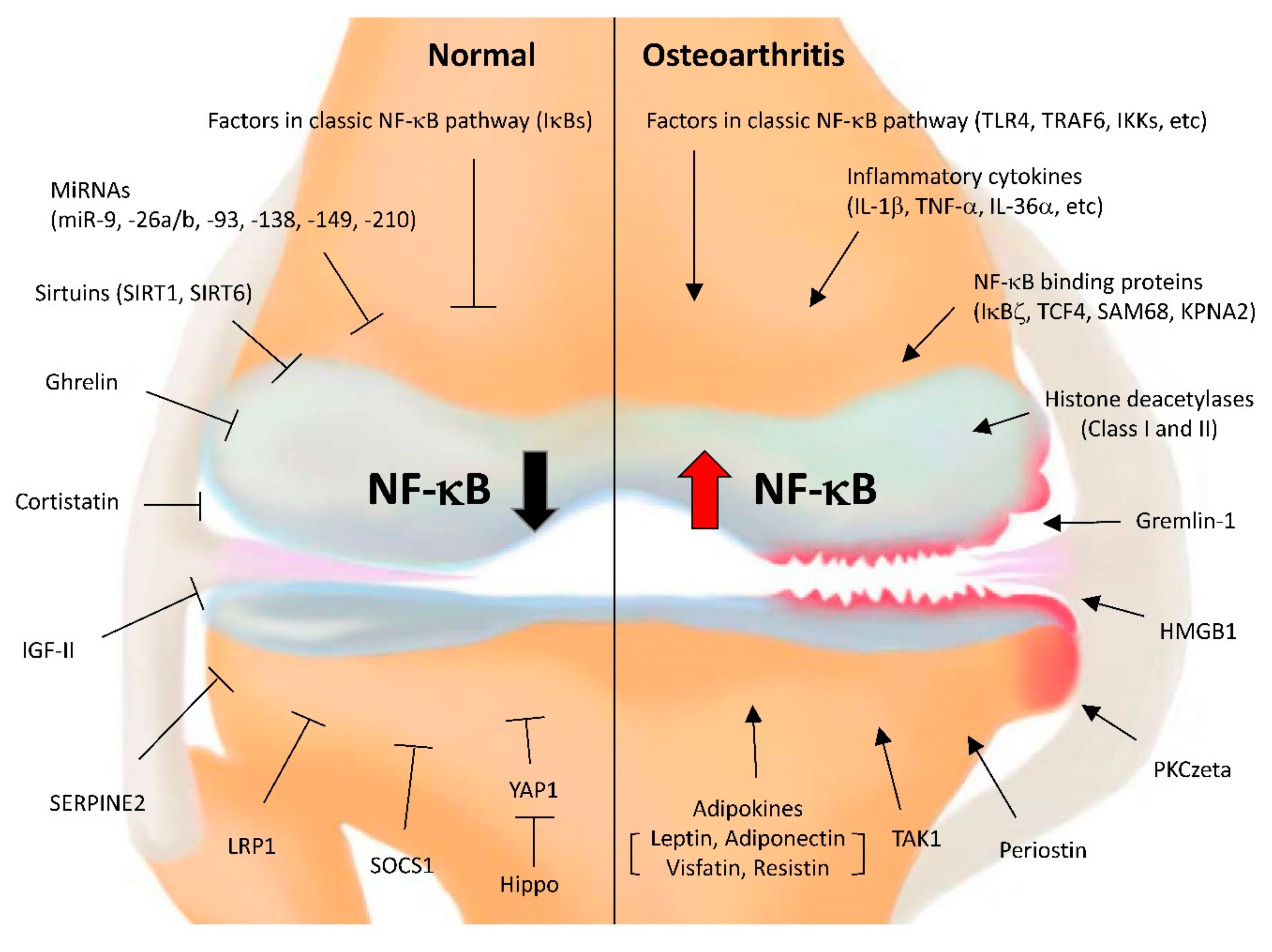 Cells | Free Full-Text | NF-κB Signaling Pathways in Osteoarthritic  Cartilage Destruction