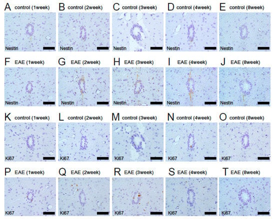 Cells Free Full Text Potential Of Adult Endogenous Neural Stem Progenitor Cells In The Spinal Cord To Contribute To Remyelination In Experimental Autoimmune Encephalomyelitis Html