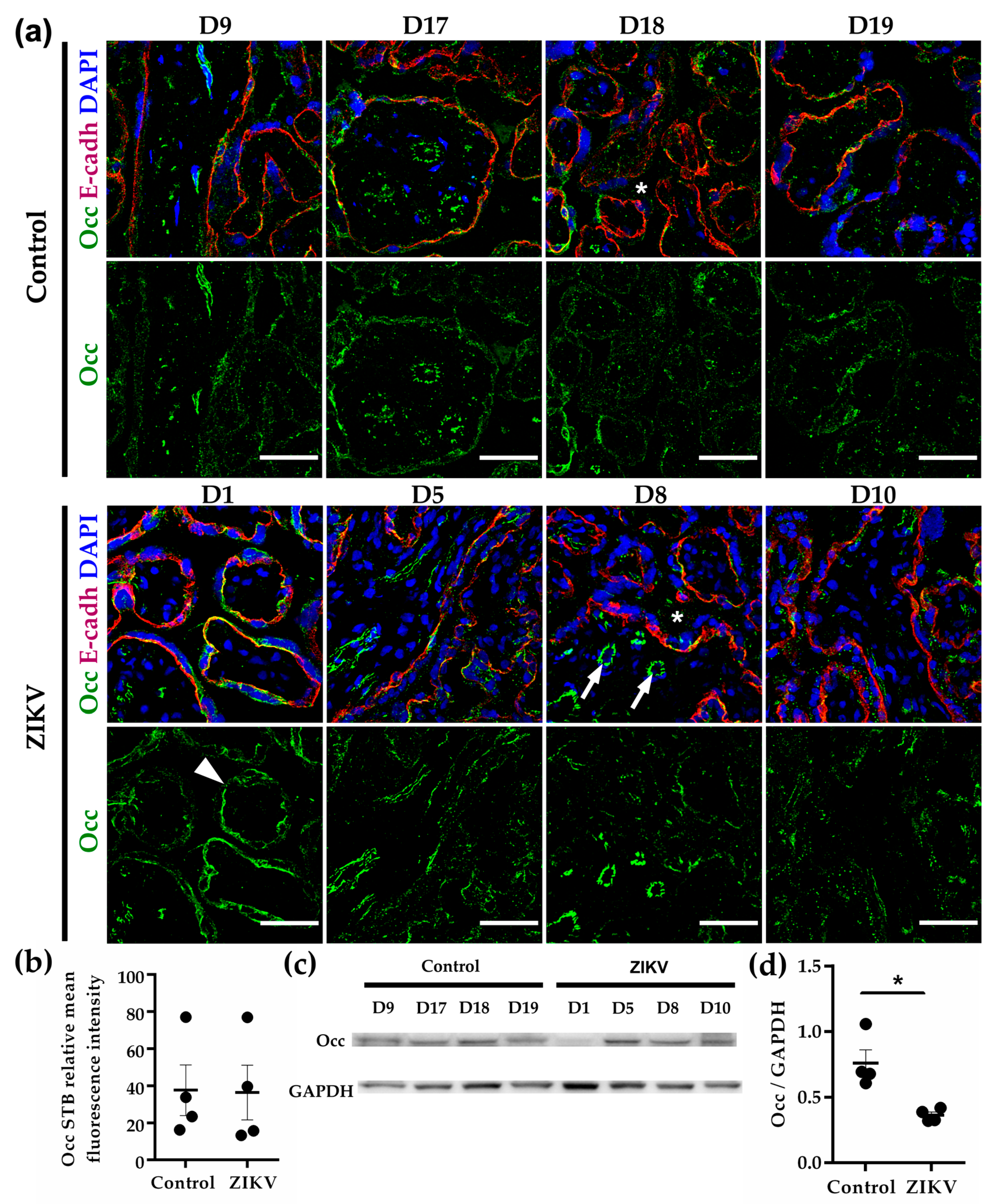 Cells Free Full Text Syncytiotrophoblast Of Placentae