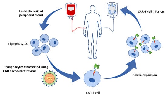 Cells | Free Full-Text | MLL-Rearranged Acute Leukemia with t(4;11)(q21 ...