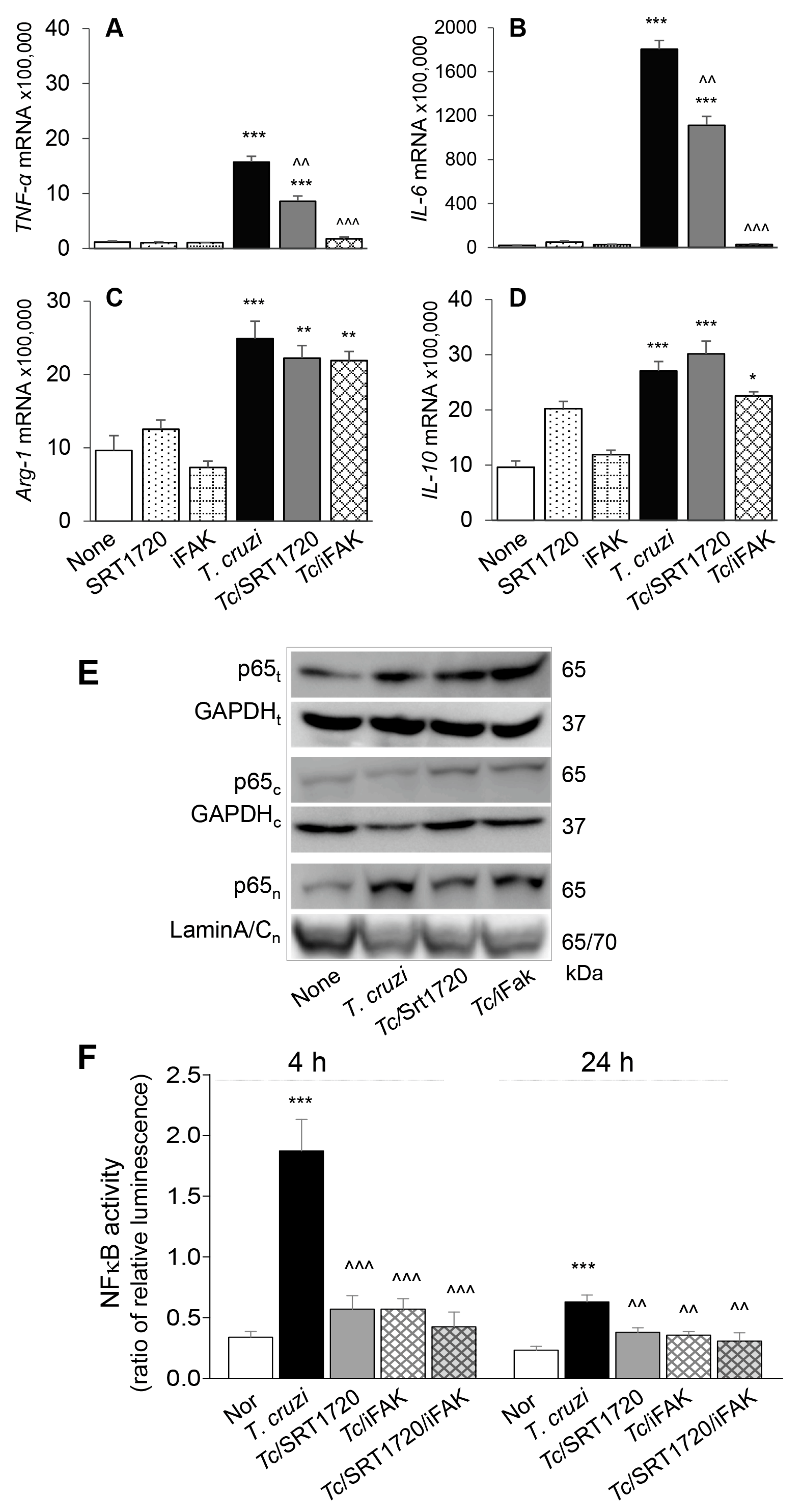 Cells Free Full Text Origin Of Monocytes Macrophages Contributing To Chronic Inflammation In Chagas Disease Sirt1 Inhibition Of Fak Nfkb Dependent Proliferation And Proinflammatory Activation Of Macrophages Html