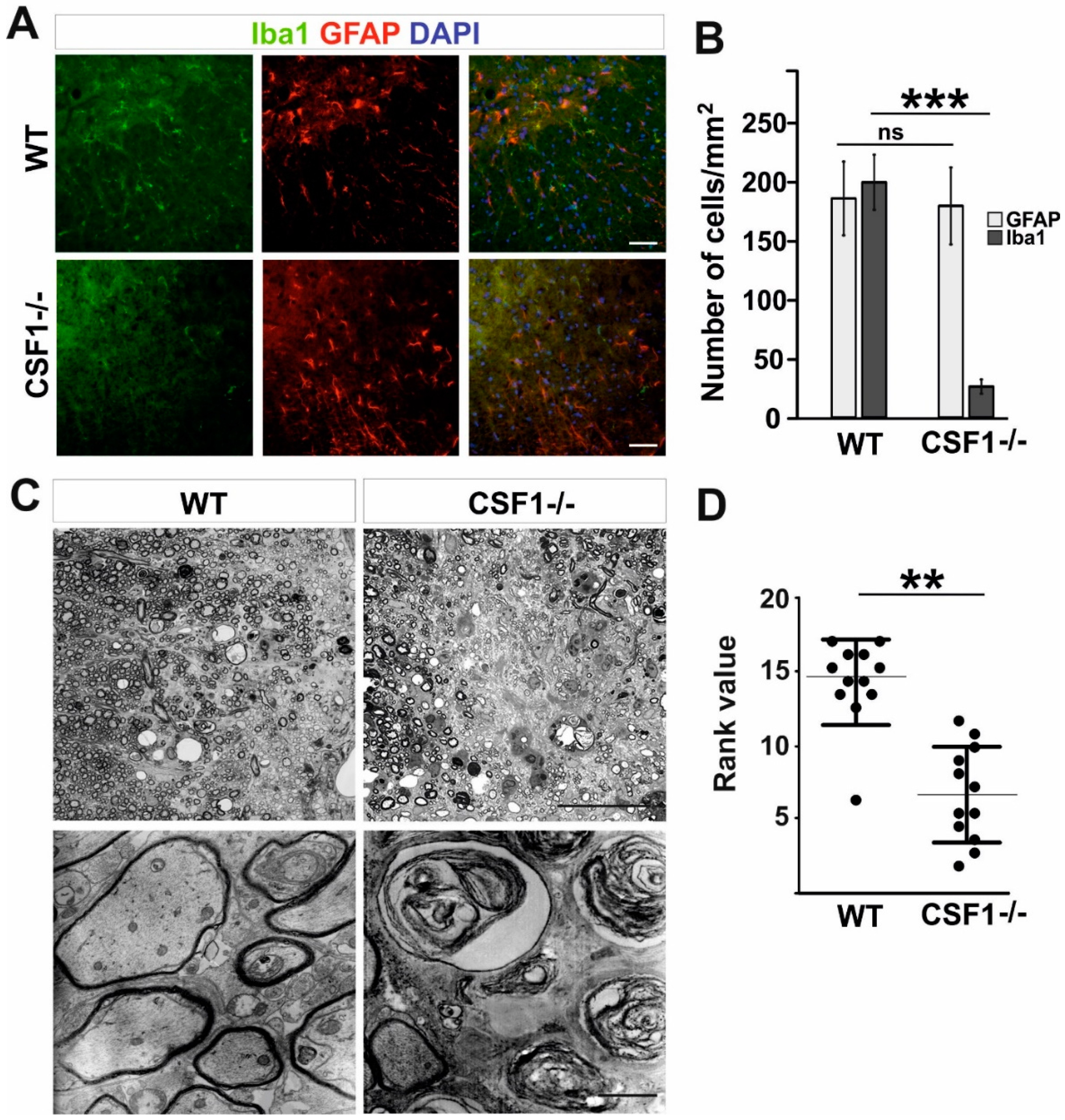 Cells | Free Full-Text | Csf1 Deficiency Dysregulates Glial Responses to  Demyelination and Disturbs CNS White Matter Remyelination