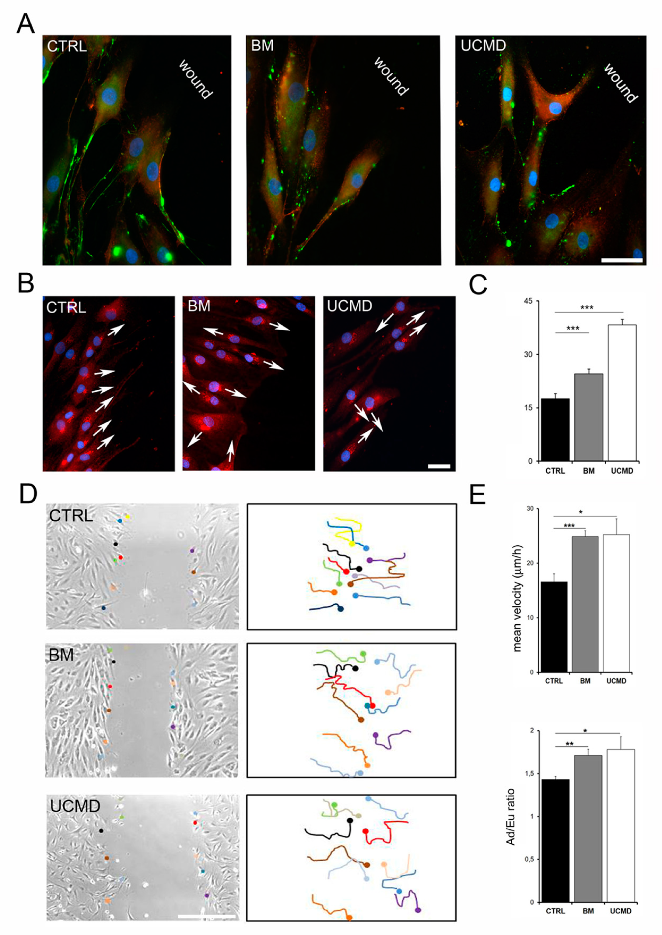 Cells | Free Full-Text | Tendon Extracellular Matrix Remodeling and  Defective Cell Polarization in the Presence of Collagen VI Mutations