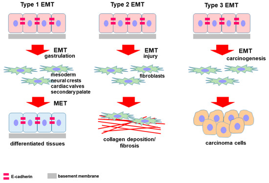 Cells | Free Full-Text | E-Cadherin in Pancreatic Ductal Adenocarcinoma: A  Multifaceted Actor during EMT