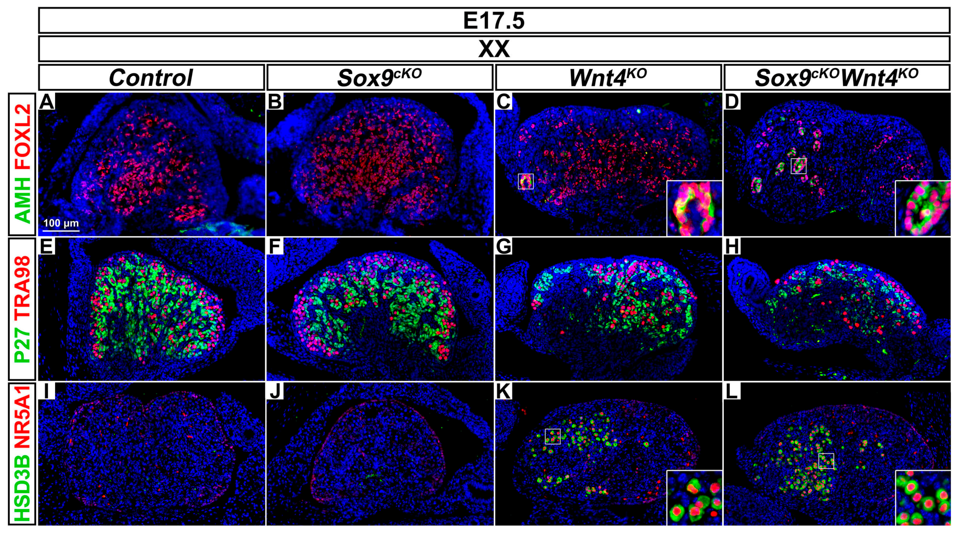 Cells | Free Full-Text | Mouse Gonad Development in the Absence of 