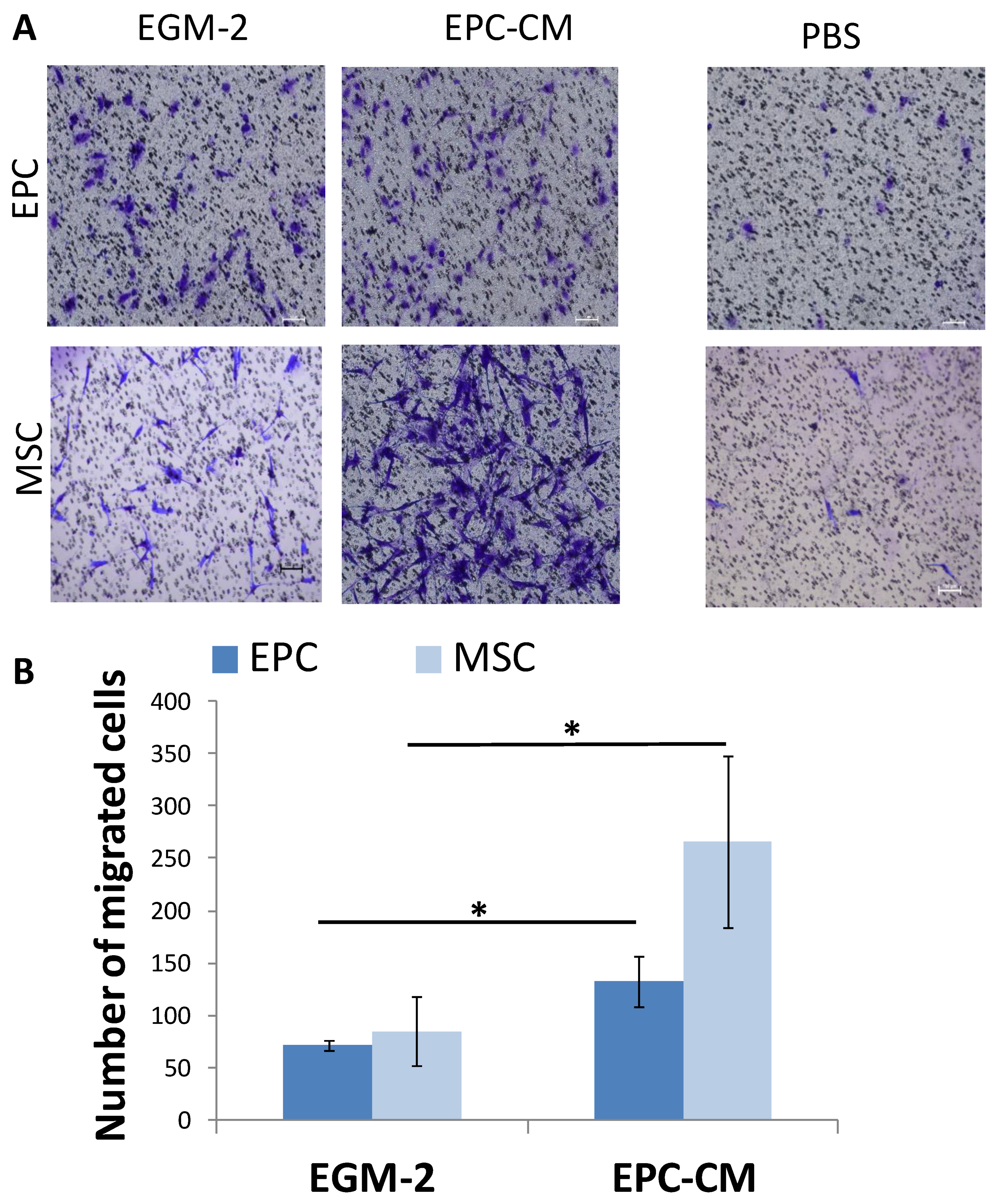 Cells Free Full Text The Paracrine Role Of Endothelial Cells In Bone Formation Via Cxcr4 Sdf 1 Pathway