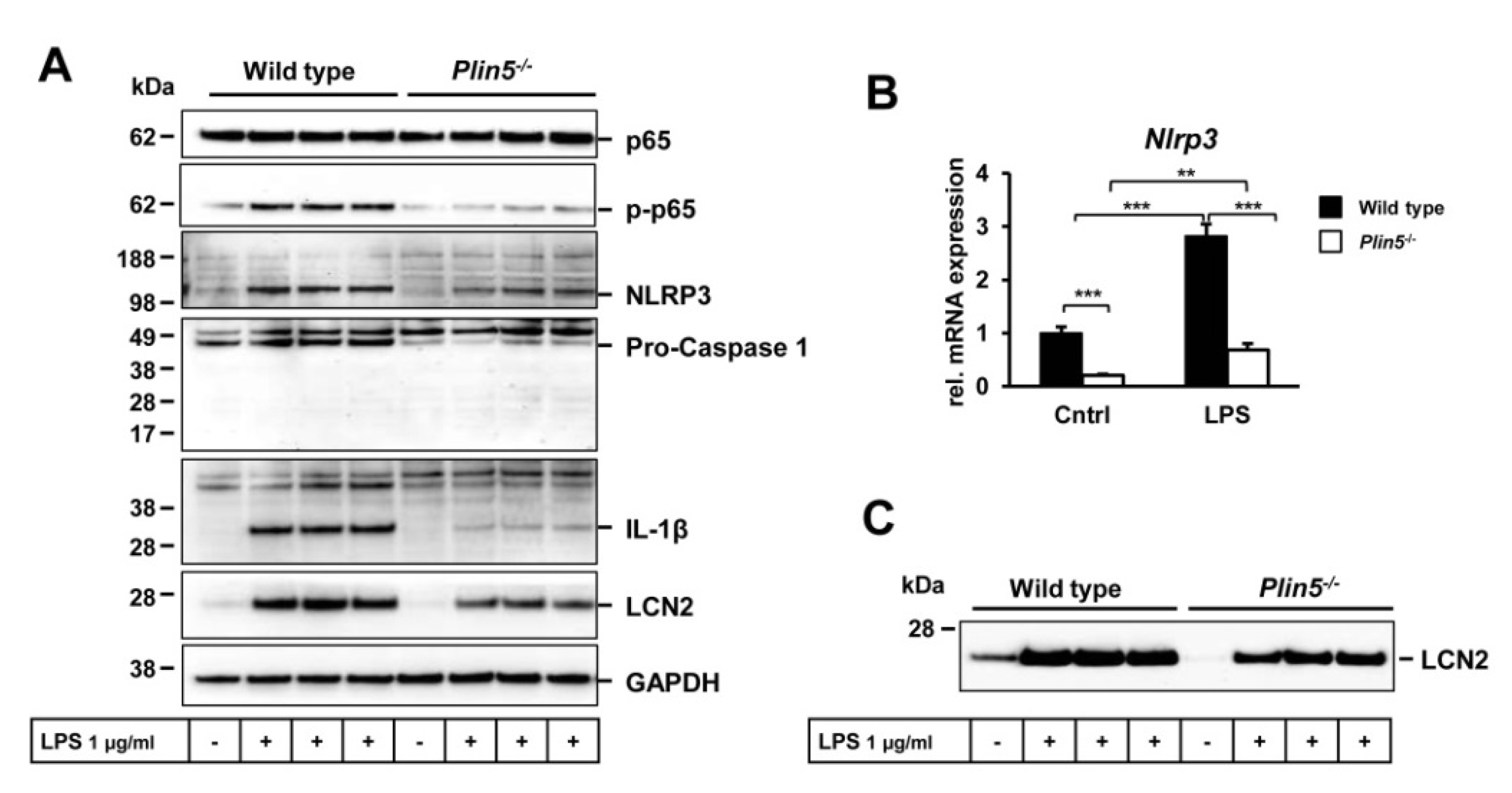 Cells | Free Full-Text | Deletion of Perilipin 5 Protects against Hepatic  Injury in Nonalcoholic Fatty Liver Disease via Missing Inflammasome  Activation | HTML