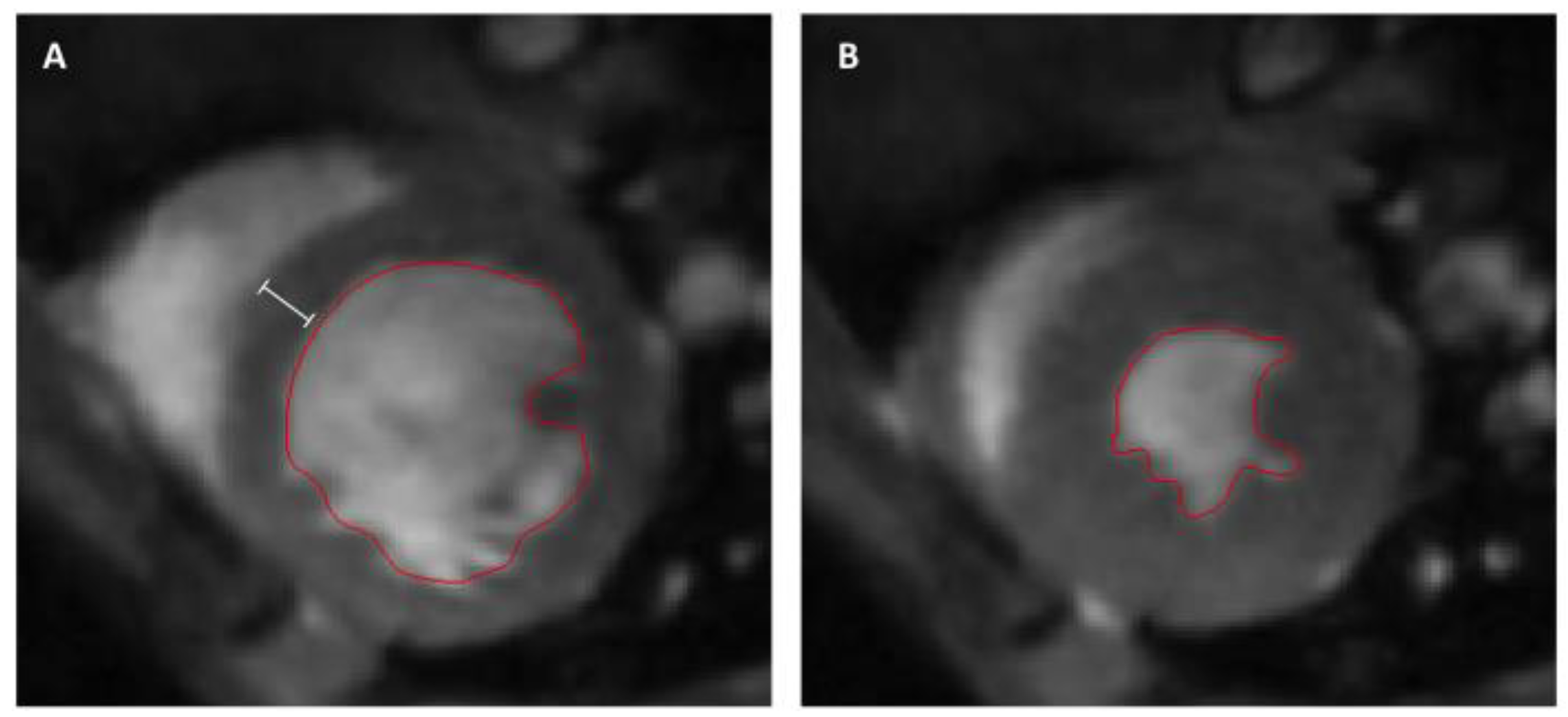 Cells | Free Full-Text | [68Ga]-NODAGA-RGD Positron Emission Tomography  (PET) for Assessment of Post Myocardial Infarction Angiogenesis as a  Predictor for Left Ventricular Remodeling in Mice after Cardiac Stem Cell  Therapy