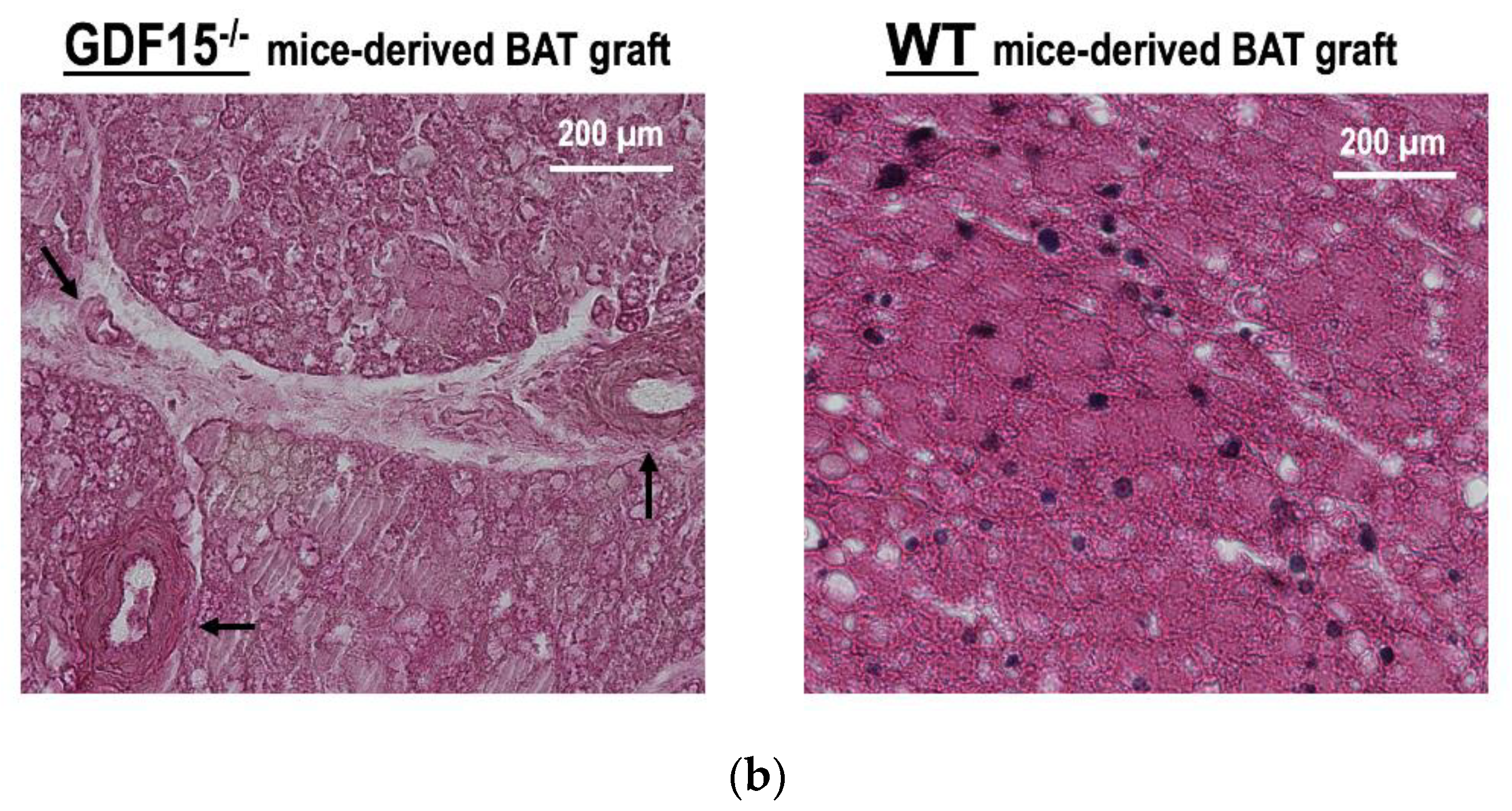 Cells 09 01365 g007b