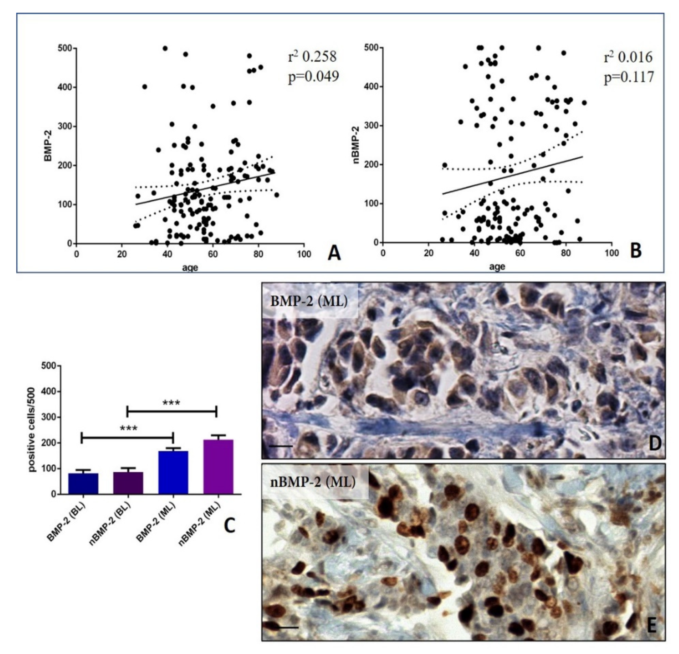 Cells Free Full Text Bmp 2 Variants In Breast Epithelial To Mesenchymal Transition And Microcalcifications Origin Html