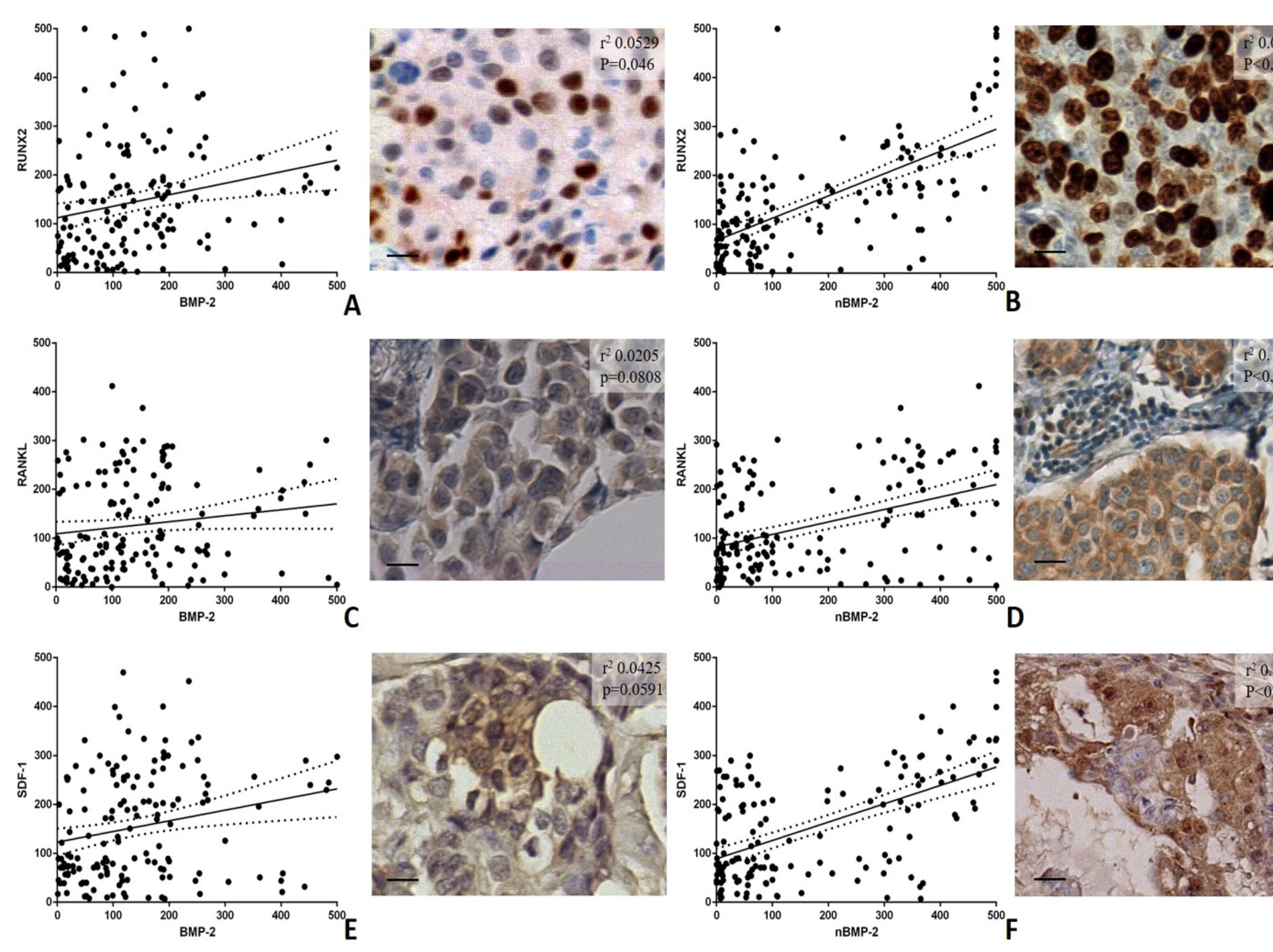 Cells Free Full Text Bmp 2 Variants In Breast Epithelial To Mesenchymal Transition And Microcalcifications Origin Html