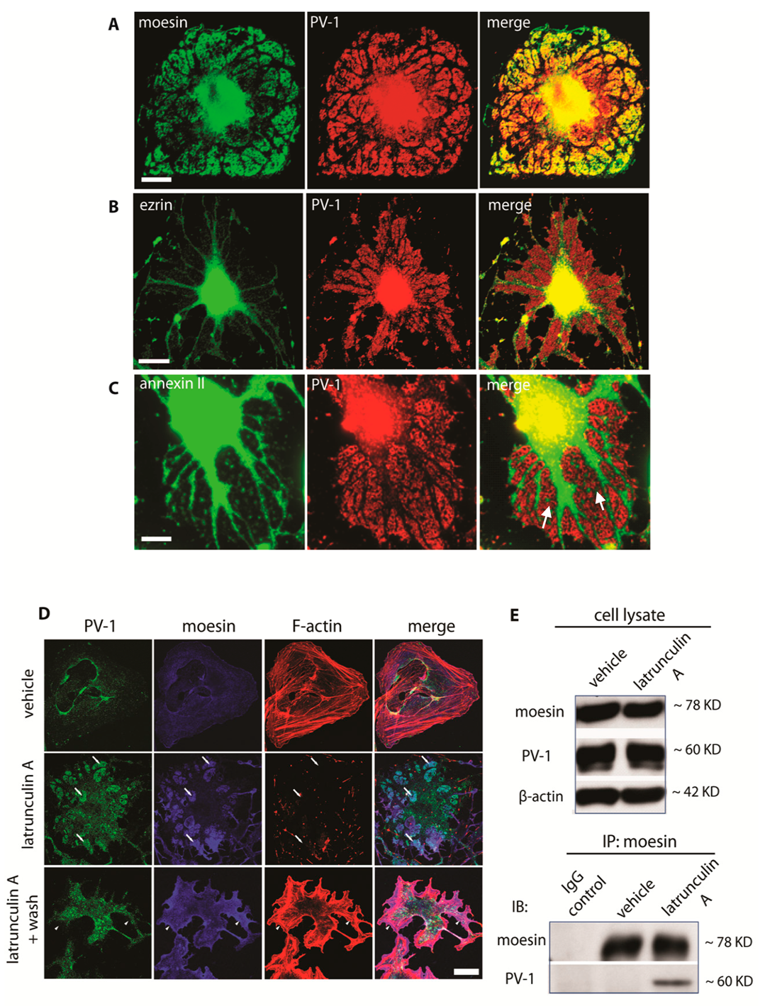 Cells Free Full Text A Na K Atpase Fodrin Actin Membrane Cytoskeleton Complex Is Required For Endothelial Fenestra Biogenesis Html