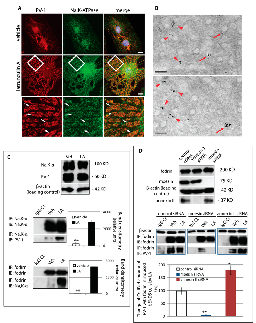 Cells Free Full Text A Na K Atpase Fodrin Actin Membrane Cytoskeleton Complex Is Required For Endothelial Fenestra Biogenesis Html