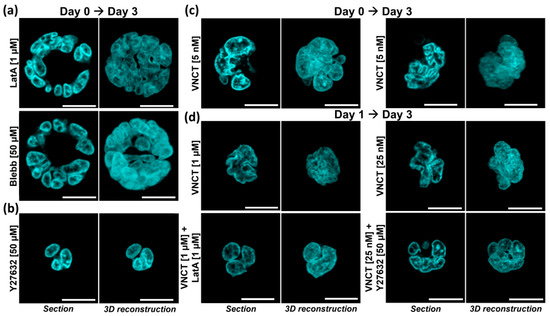 Cells | Free Full-Text | Nuclear Morphological Remodeling in Human