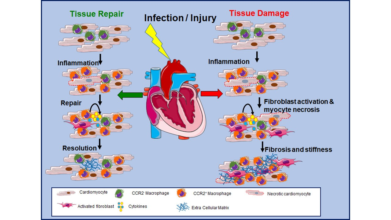 Cells | Free Full-Text | Role of Cardiac Macrophages on Cardiac  Inflammation, Fibrosis and Tissue Repair | HTML