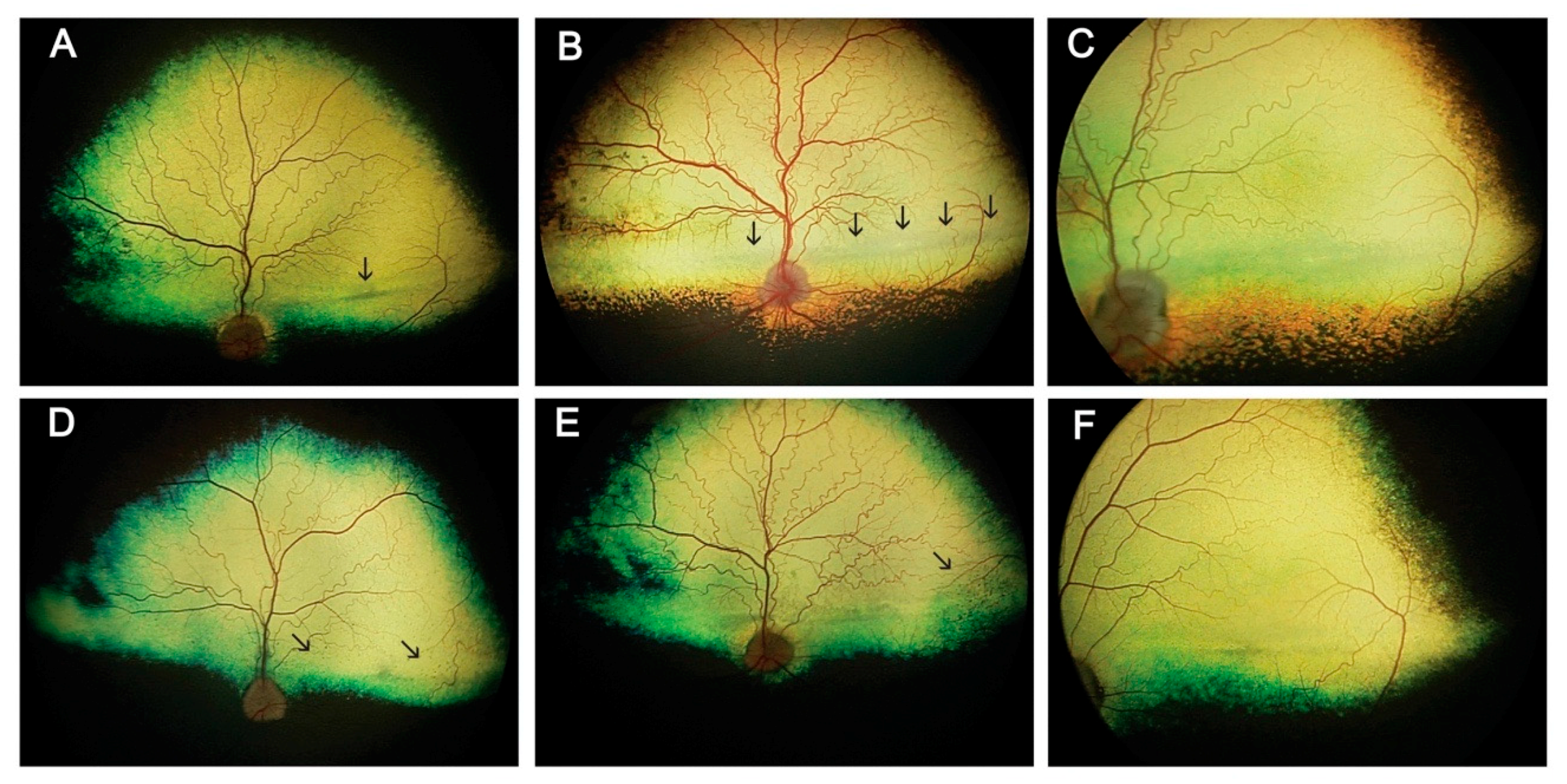 Cells Free Full Text A Comprehensive Study Of The Retinal Phenotype Of Rpe65 Deficient Dogs Html