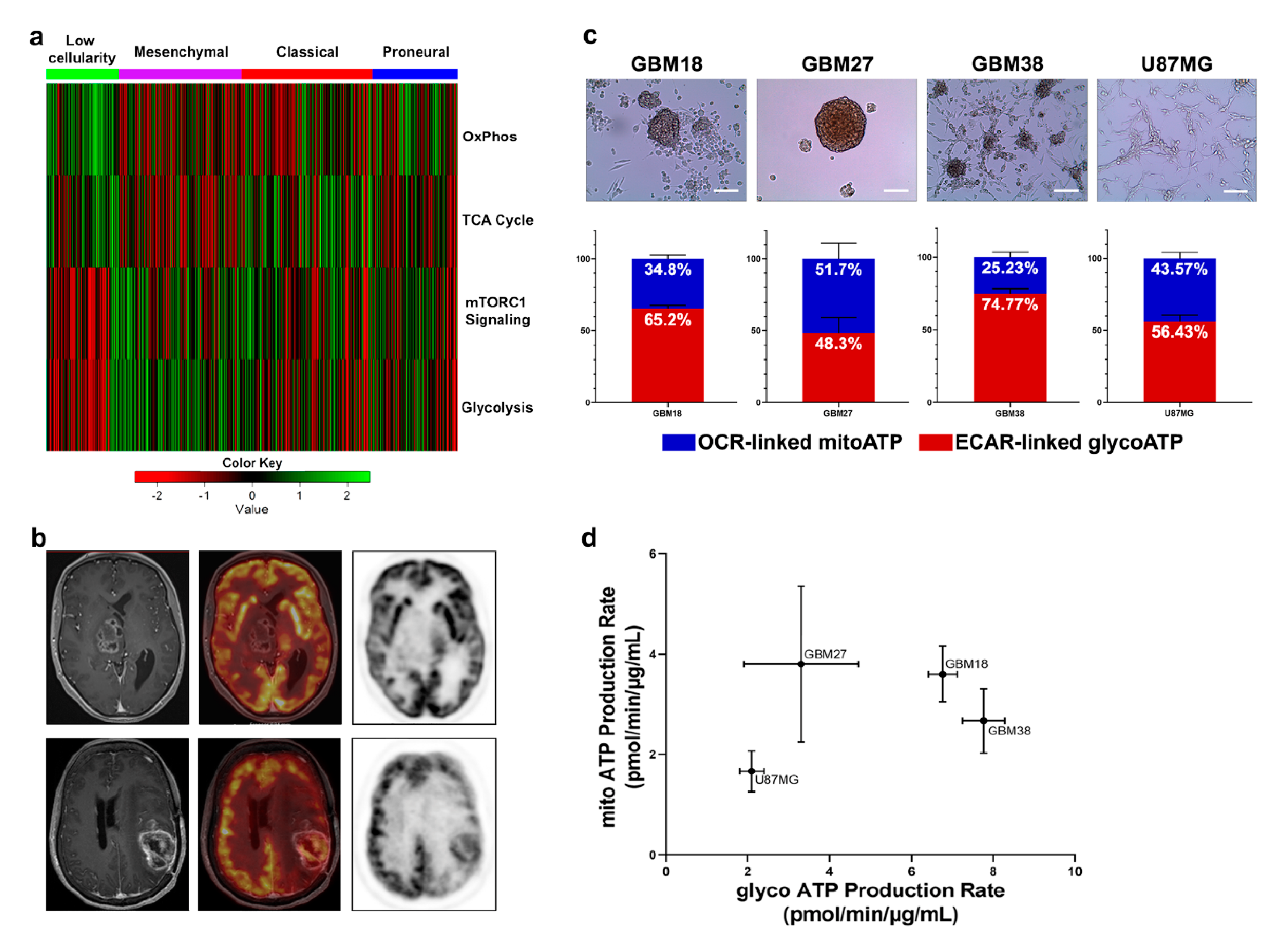 Cells | Free Full-Text | Beyond the Warburg Effect: Oxidative and  Glycolytic Phenotypes Coexist within the Metabolic Heterogeneity of  Glioblastoma
