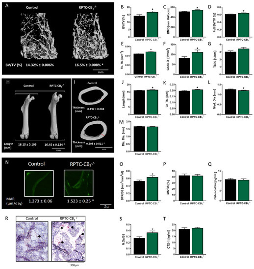 Cells | Free Full-Text | Renal Proximal Tubule Cell Cannabinoid-1 Receptor  Regulates Bone Remodeling and Mass via a Kidney-to-Bone Axis