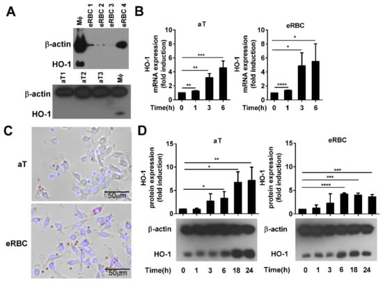 Cells | Free Full-Text | Heme Oxygenase-1 Contributes to Both the  Engulfment and the Anti-Inflammatory Program of Macrophages during  Efferocytosis