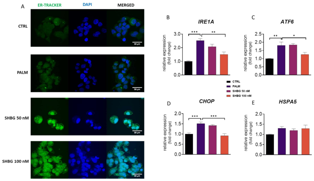 Cells | Free Full-Text | Sex Hormone Binding Globulin (SHBG) Mitigates ER  Stress in Hepatocytes In Vitro and Ex Vivo