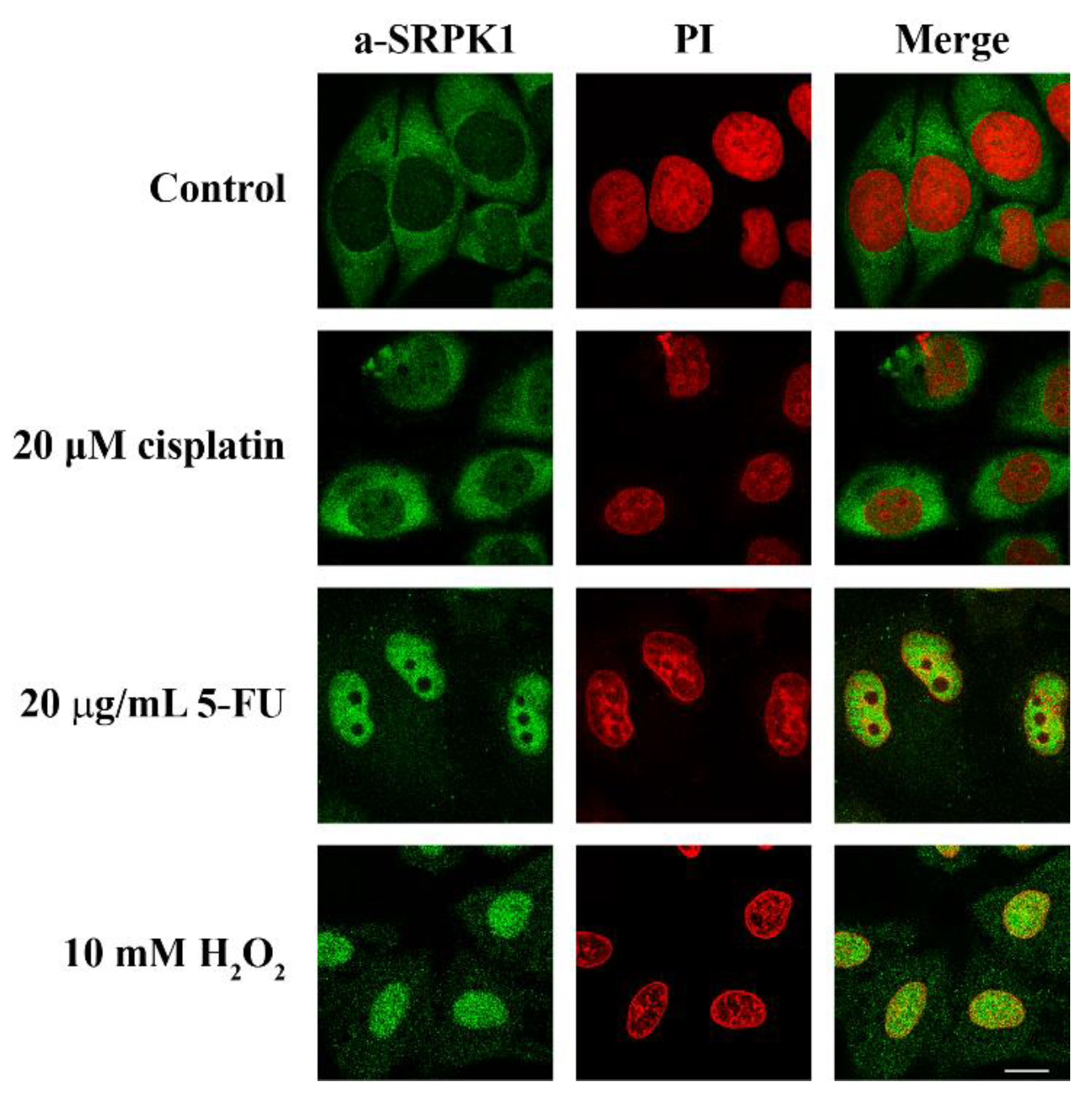 Cells Free Full Text Nuclear Translocation Of Srpks Is Associated With 5 Fu And Cisplatin Sensitivity In Hela And T24 Cells Html