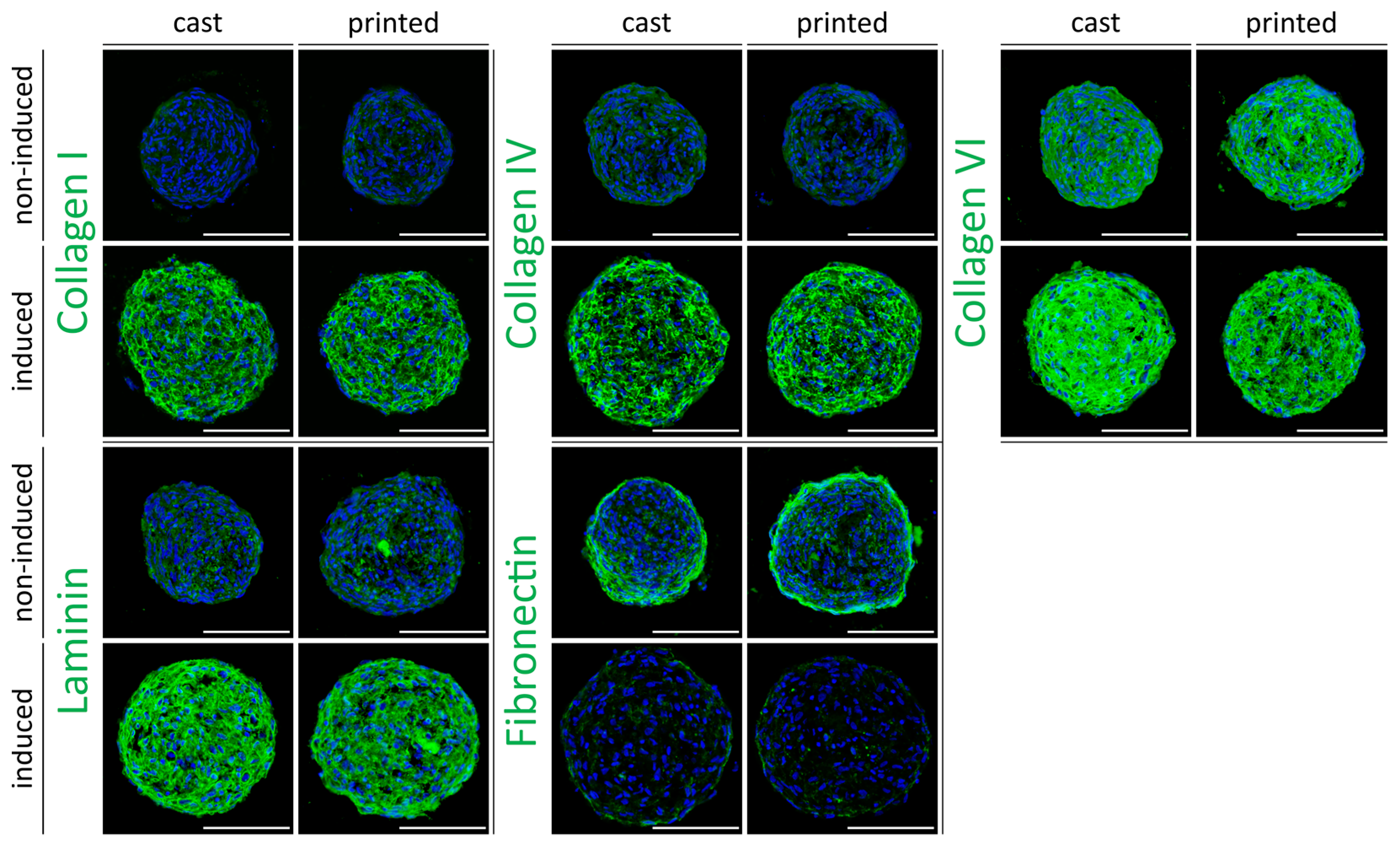 Cells Free Full Text Bioprinting And Differentiation Of Adipose Derived Stromal Cell Spheroids For A 3d Breast Cancer Adipose Tissue Model Html