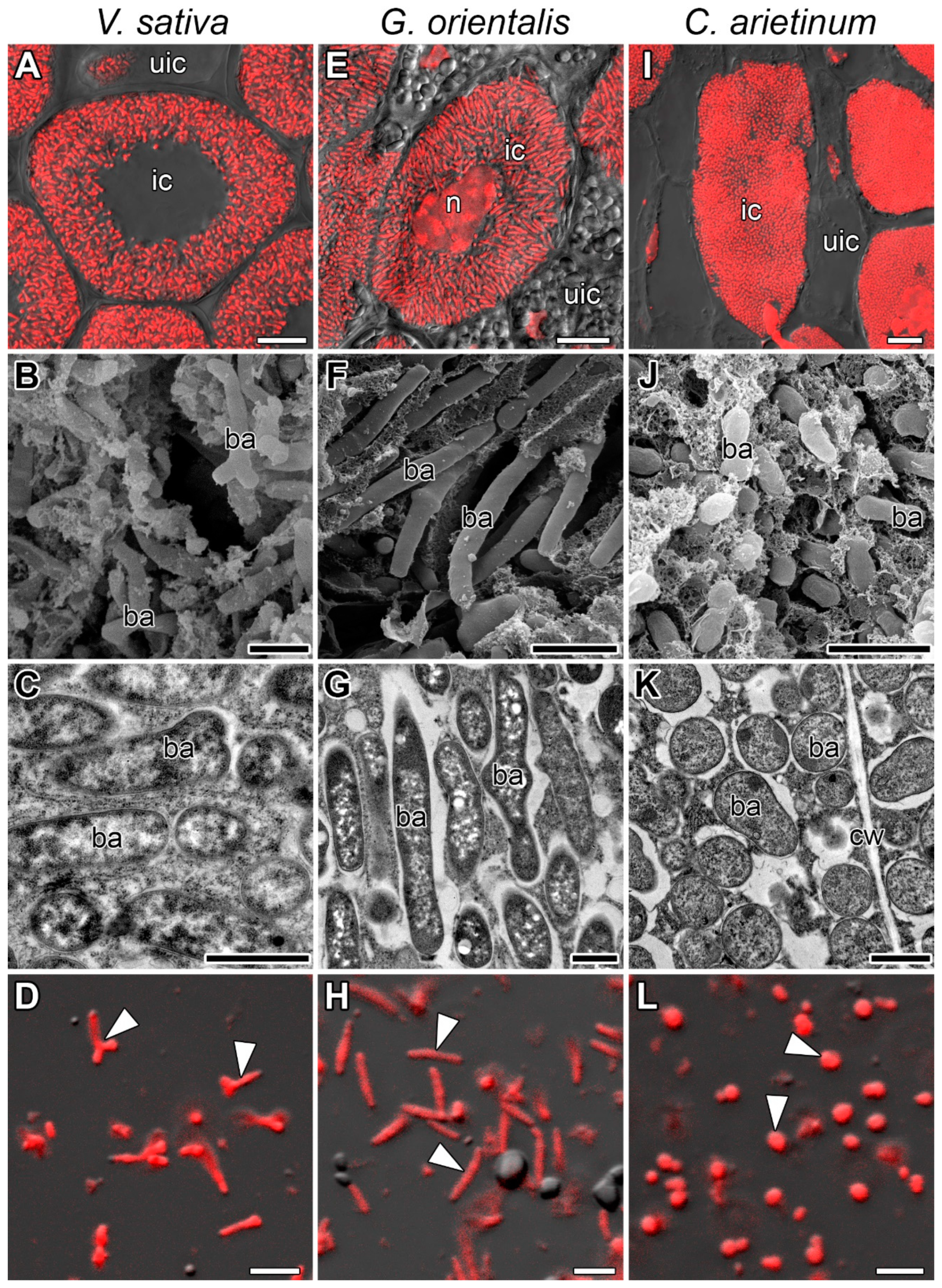 Cells Free Full Text General Patterns And Species Specific Differences In The Organization Of The Tubulin Cytoskeleton In Indeterminate Nodules Of Three Legumes Html